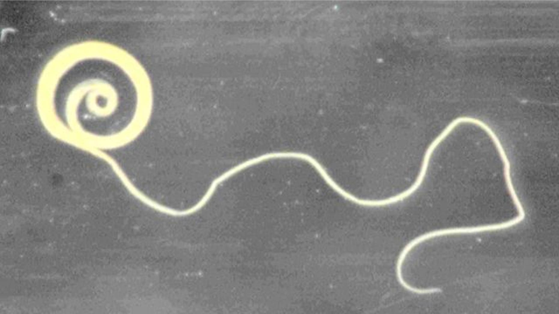 In Light Of Autism Comments White House >> How Parasitic Worms And Hot Tubs May Treat Autism Symptoms Fox News In Light Of Autism Comments White House >> How Parasitic Worms And Hot Tubs May Treat Autism Symptoms Fox News