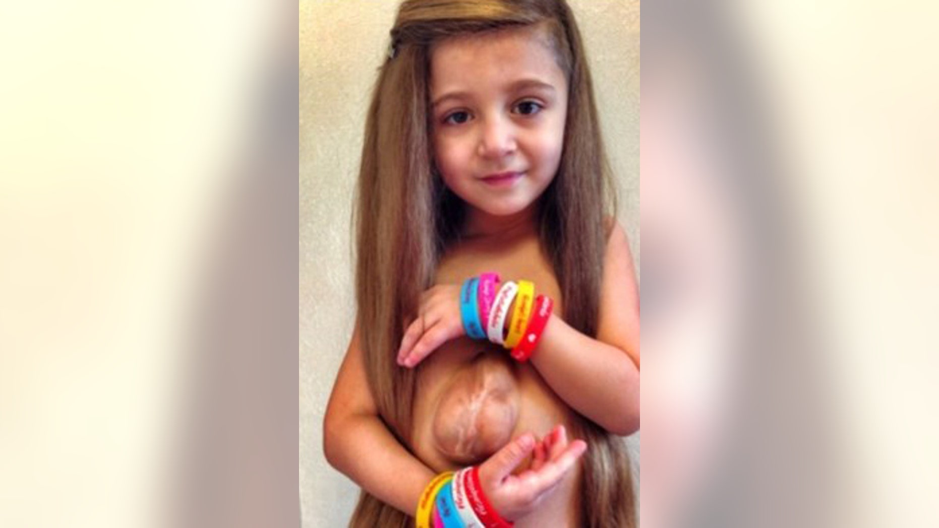 Virsaviya "Bathsheba" Borun is a 6 and a half year old girl who have a rare condition called Pantalogy of Cantrell.