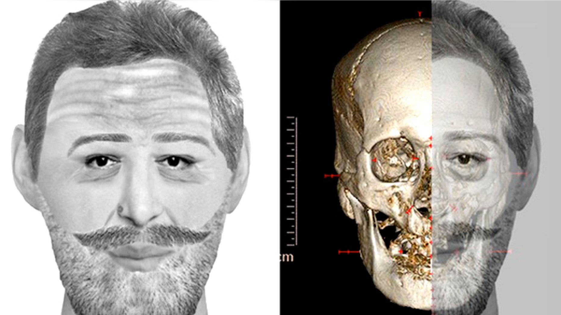 A reconstruction of the mummified skull matched Henry IV's features.