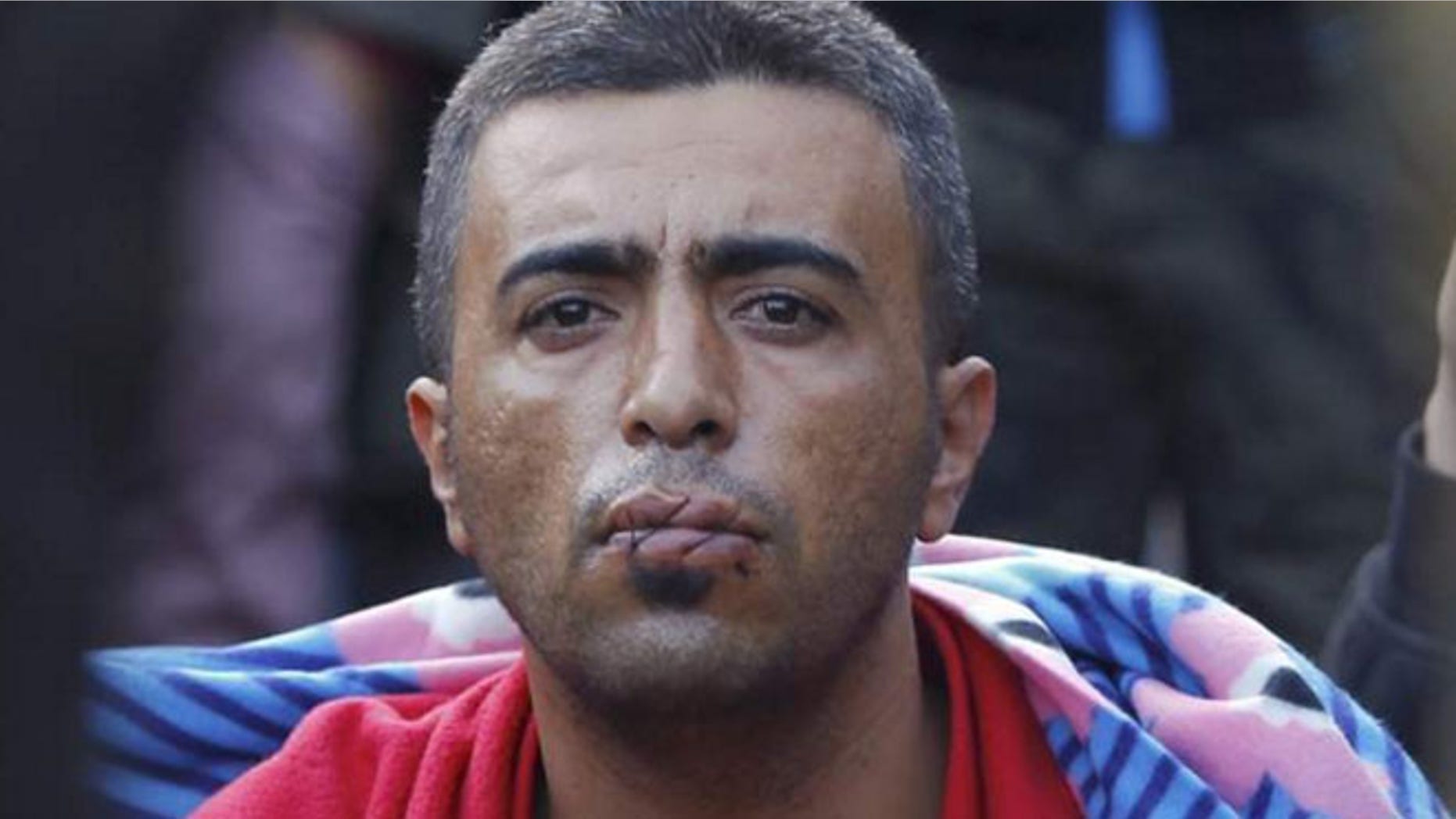 Several refugees have sewn their lips together with a cord.