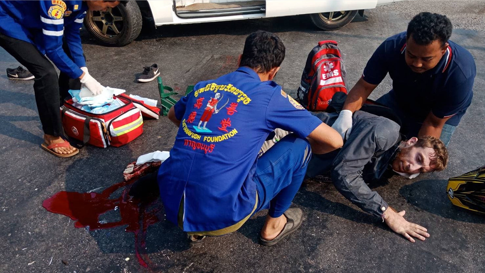 A British man had his right leg amputated and is fighting for his life after a horror motorbike crash in Thailand.