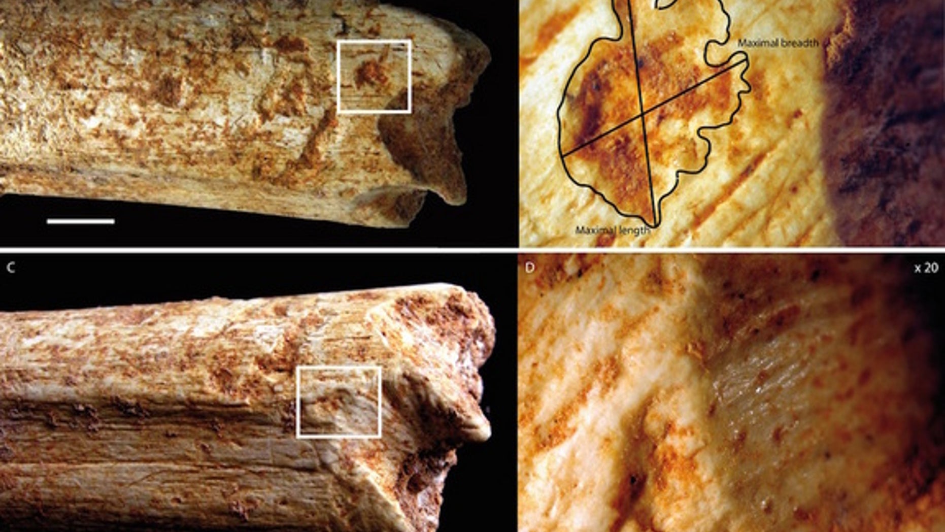Researchers found carnivore tooth marks on the ends of a hominin femur bone. The close-ups on the right are magnified 20 times.