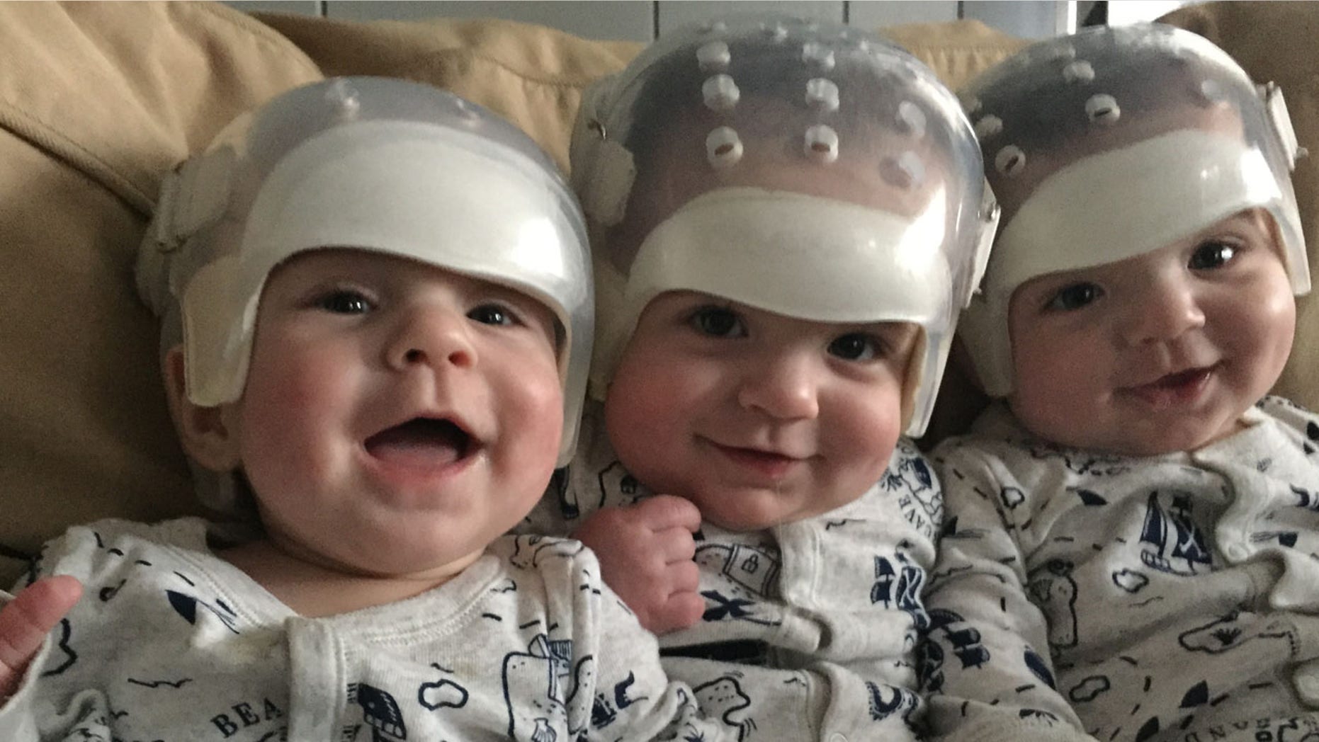 Hunter, Jackson and Kaden were diagnosed with variations of Craniosynostosis