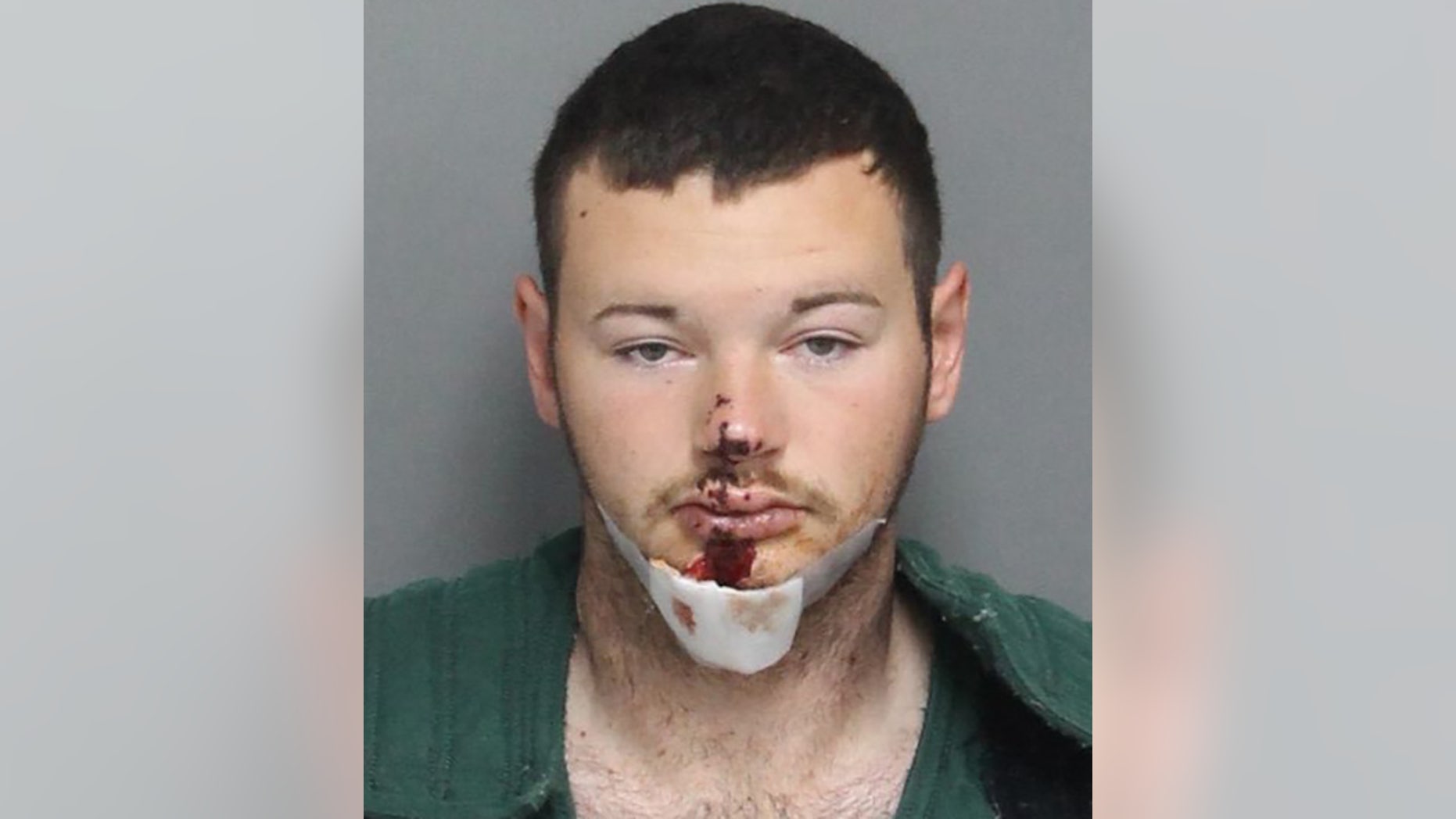 Colton Hurley, 20, shot himself in the face after holding a woman against her will and fatally shooting a horse, police said.