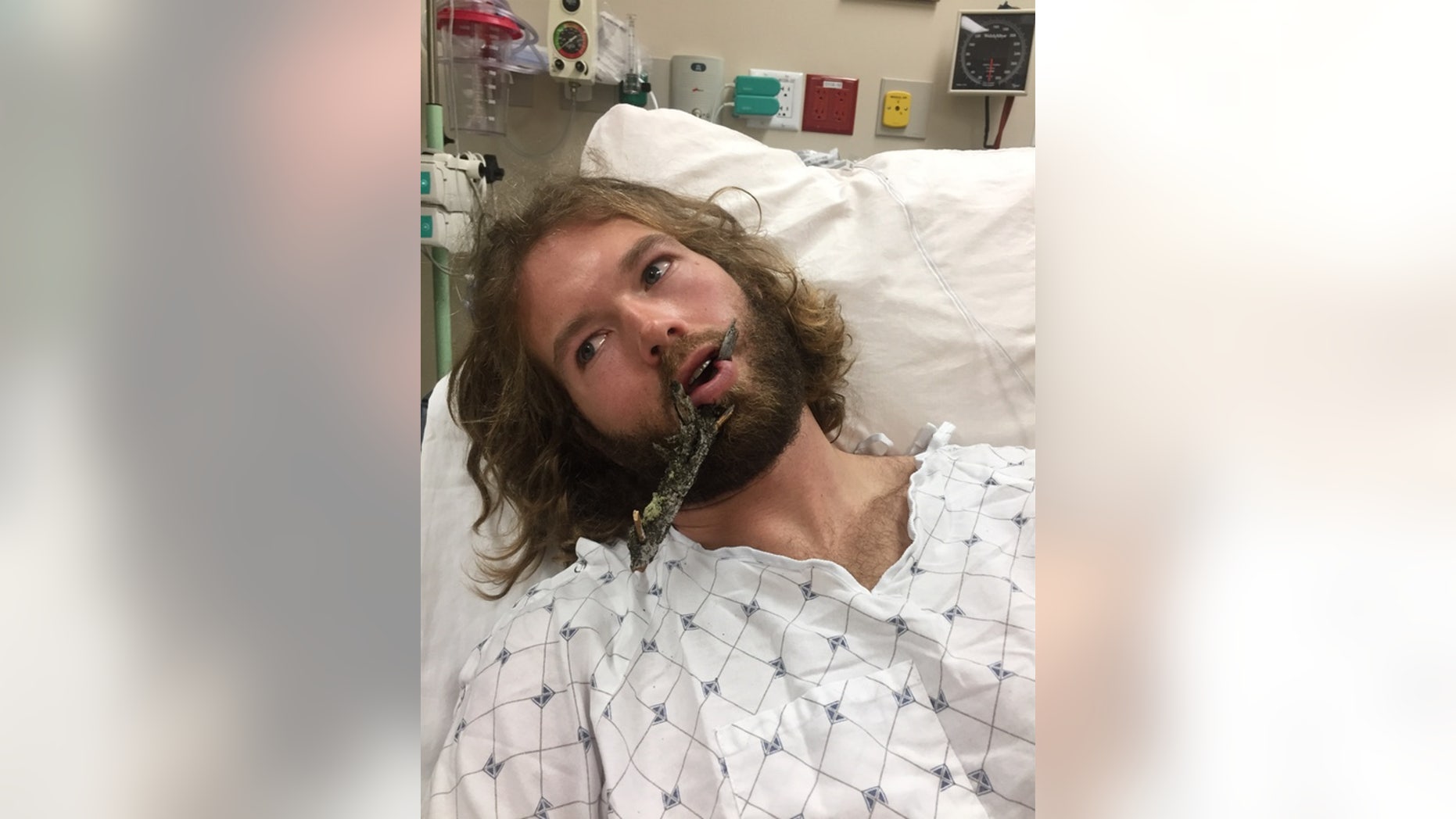 Natty Hagood, 29, was impaled by a tree branch while skiing at the Jackson Hole Mountain Resort.