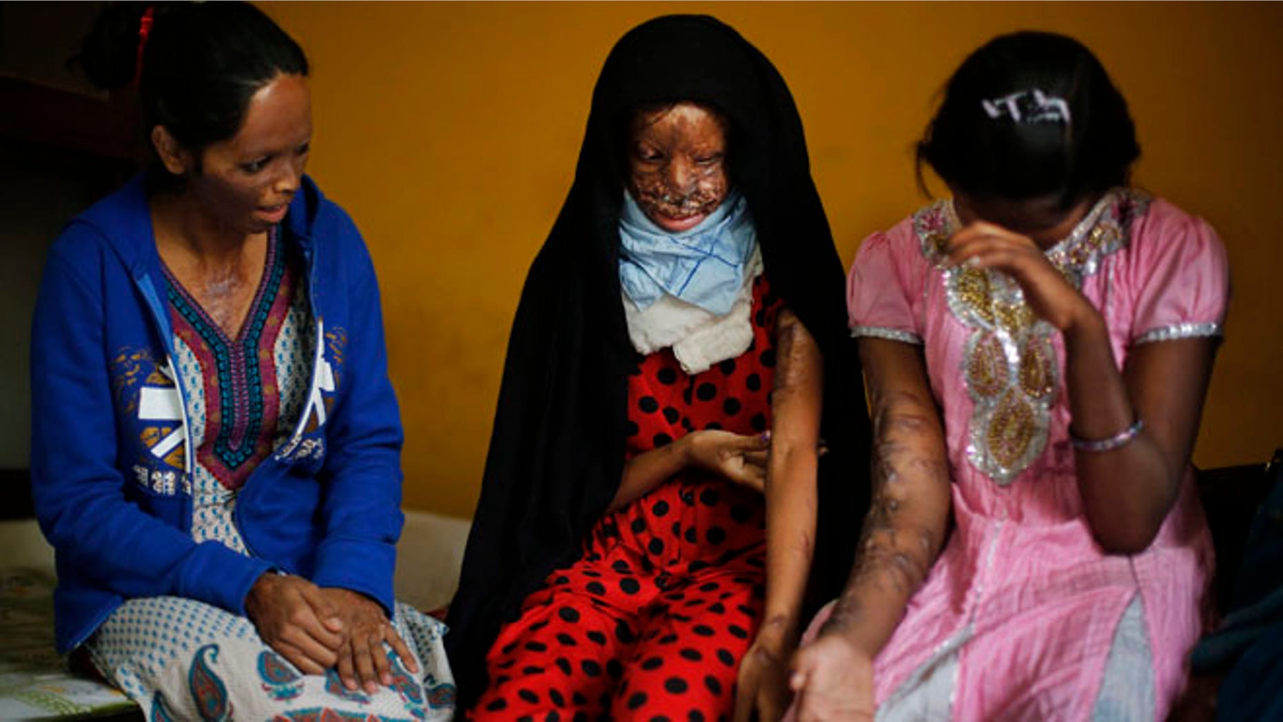 Dec. 5, 2013: In this photo, acid attack victims, from left, Laxmi, 24, Chanchal, 19, and Sonam, 16, interact in the office of the Indian NGO Stop Acid Attacks, in New Delhi, India. Victims of acid attacks are pressing the Indian government to do more to prevent such violence, saying a new law aimed at restricting the sale of dangerous is being ignored. Highly concentrated acids are readily available in India for use as household and industrial cleaners.