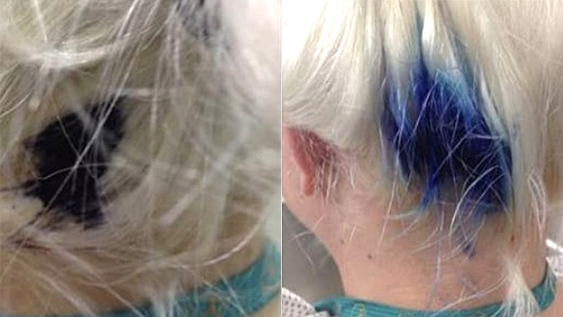 An ink pen exploded in a bride's hair days before her wedding, leaving behind a massive blue stain.