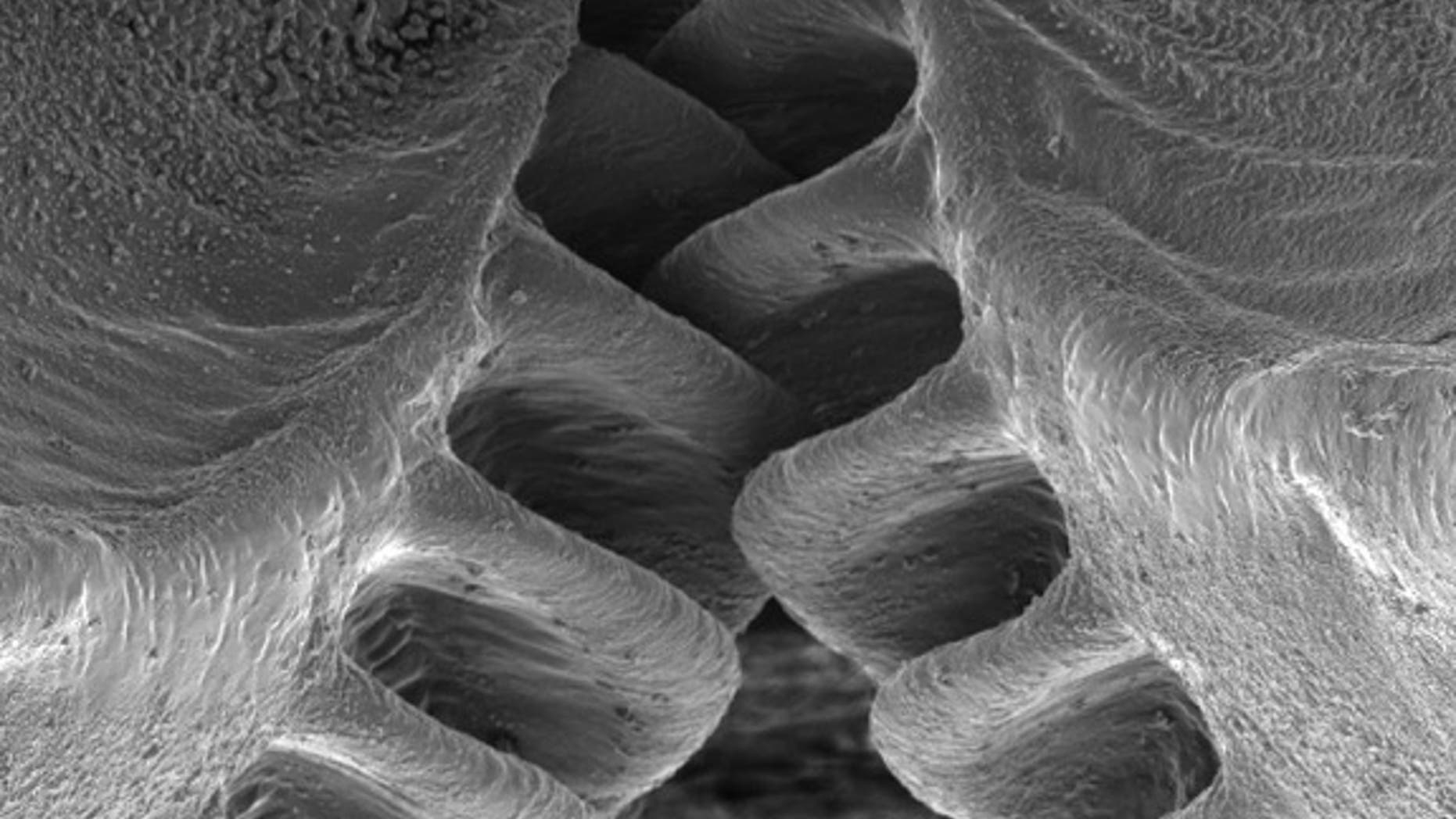 The intermeshing gears on the hind legs of a planthopper insect are shown in this scanning electron micrograph image.