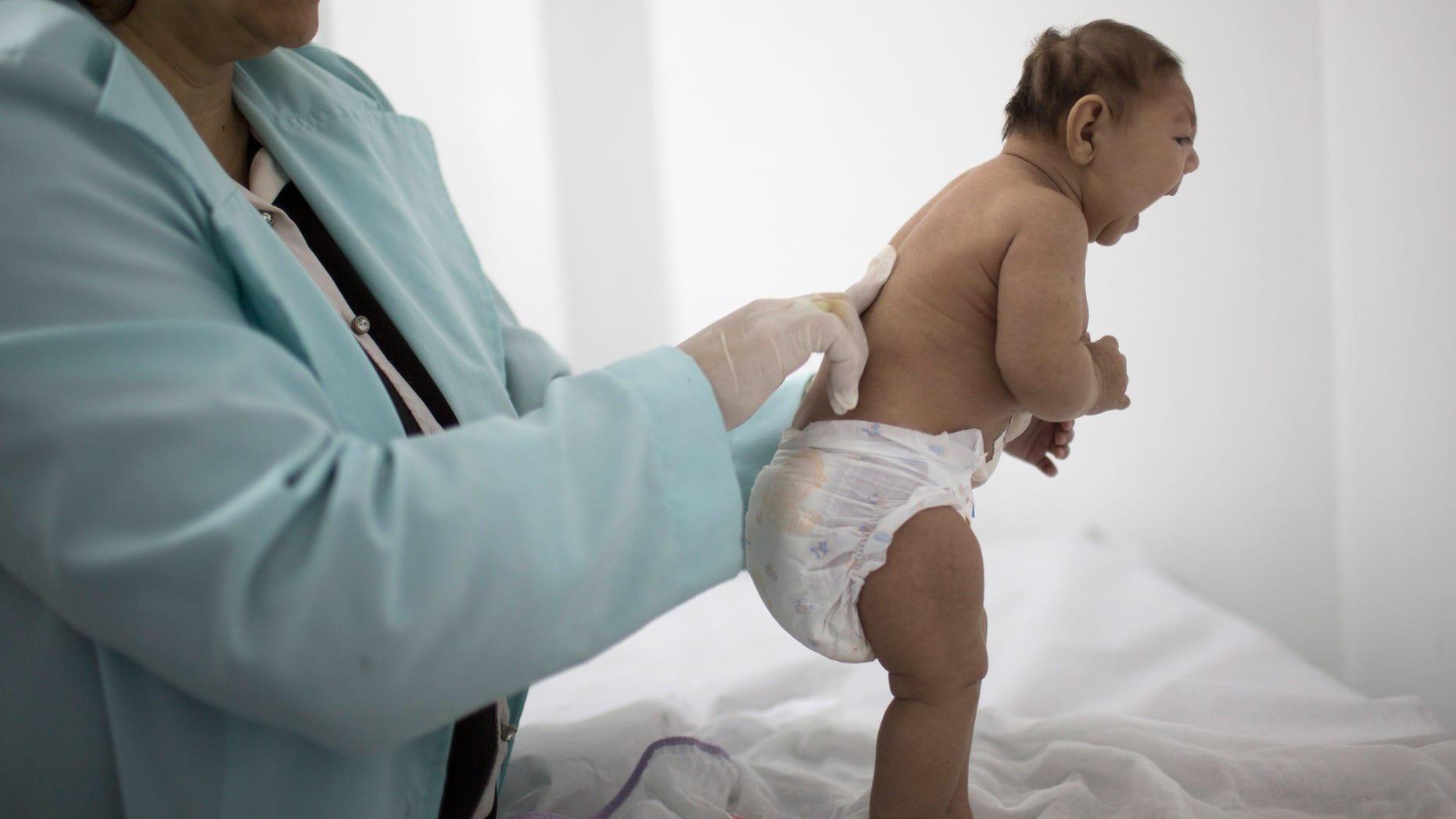 FILE - In this Friday, Feb. 12, 2016 file photo, Lara, who is less then 3-months old and was born with microcephaly, is examined by a neurologist at the Pedro I hospital in Campina Grande, Paraiba state, Brazil. Scientists suspect an outbreak of the Zika virus is behind a surge in a rare birth defect in Brazil. But how are they going to prove it? Authorities in the South American country were quick to make the link last fall. But experts say the evidence is still circumstantial. Several studies are underway in Zika outbreak countries to see if the mosquito-borne virus is the actual case. (AP Photo/Felipe Dana, File)