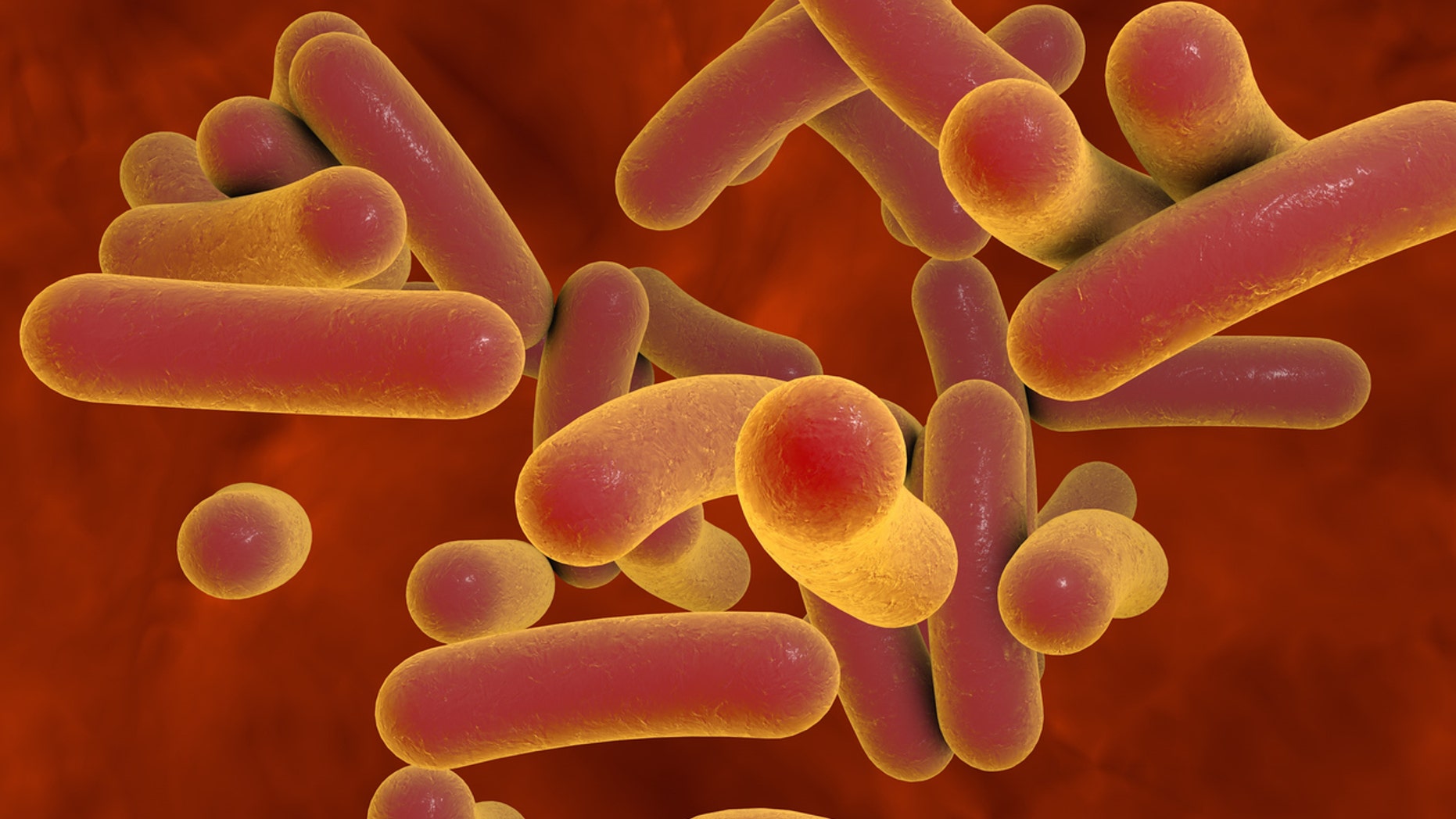 The employee contracted <em>Salmonella Typhi</em>, which causes typhoid fever.