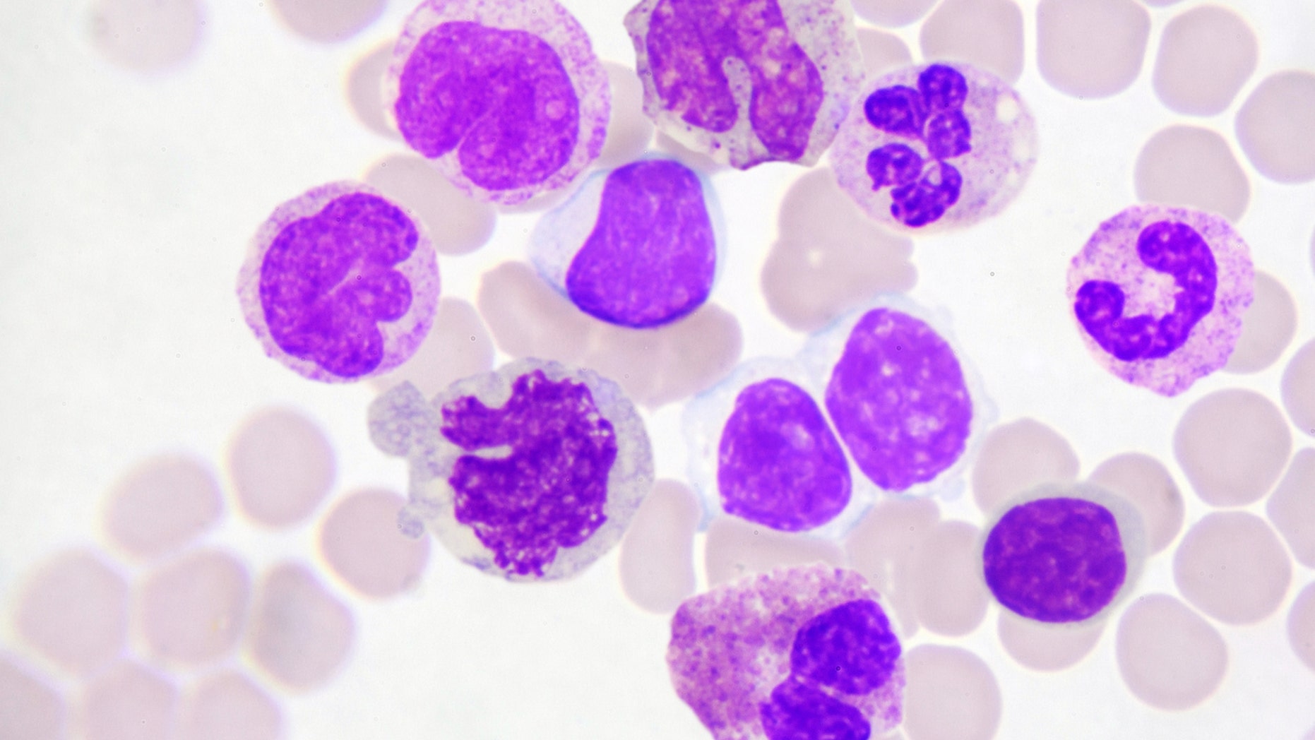 The pathogen has also been dubbed a cousin of HIV because of the similarities in the way it’s spread.