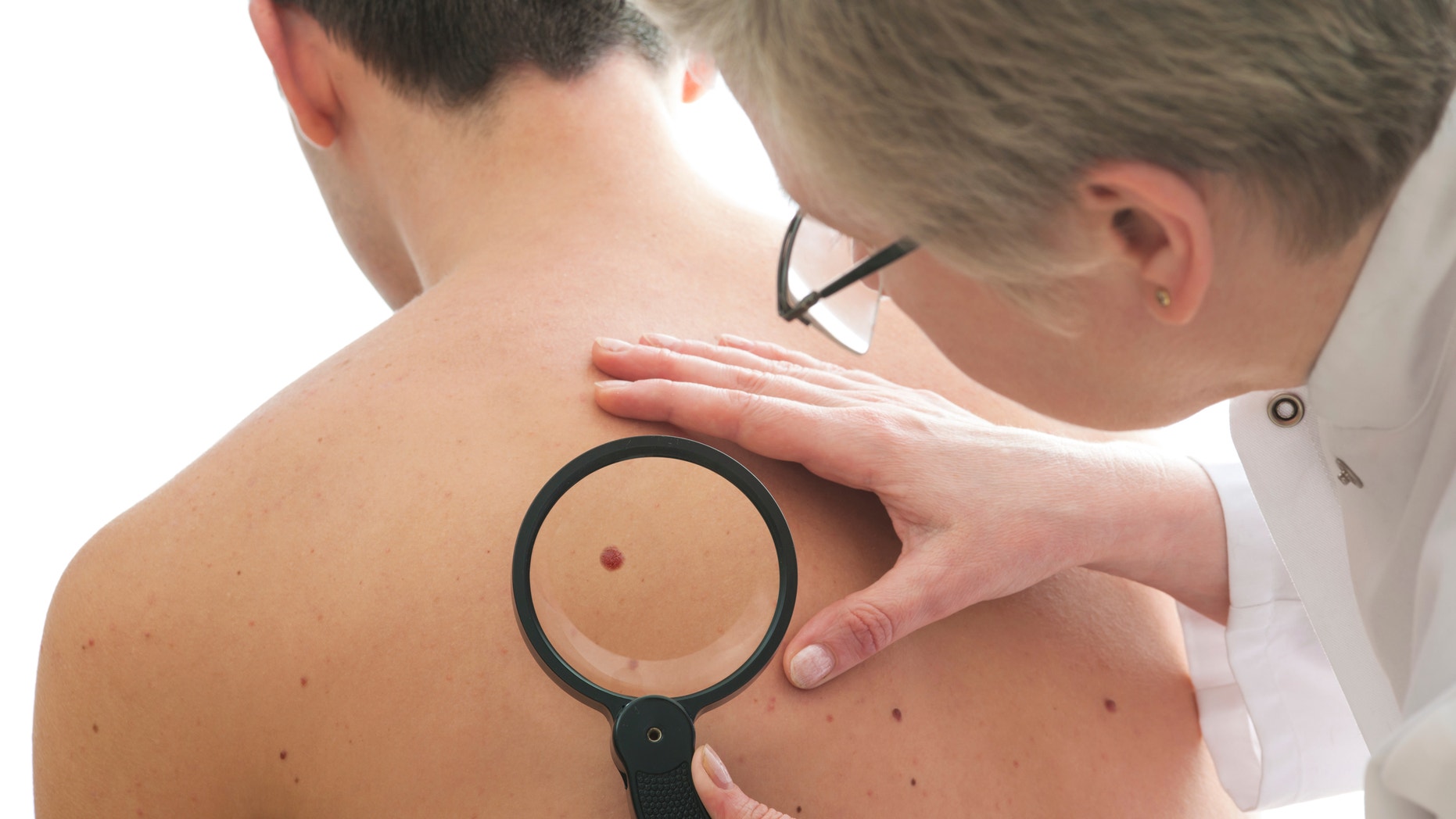 Dermatologist examines a mole of male patient