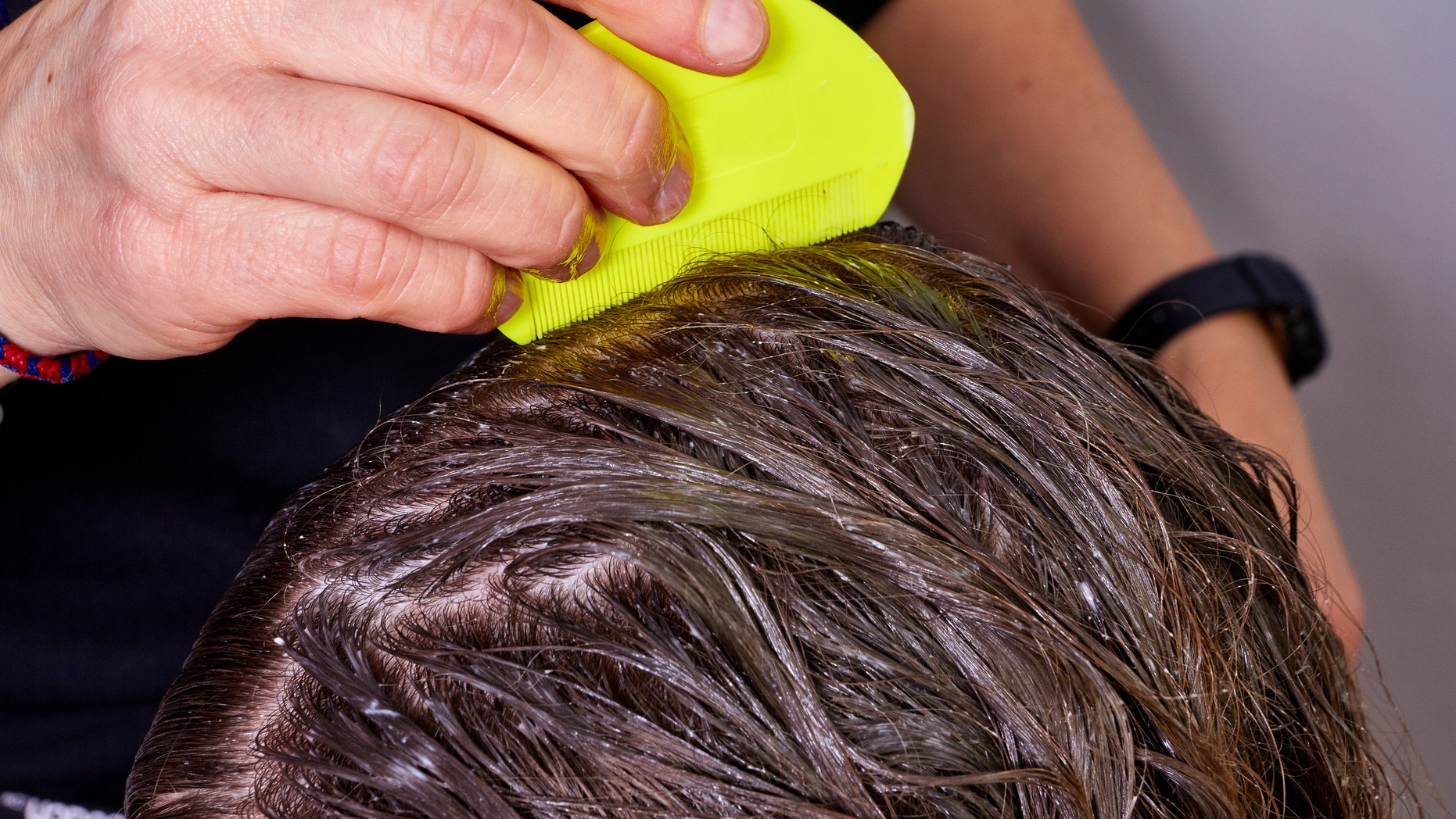 person checking wet hair for lice, with a yellow lice comb