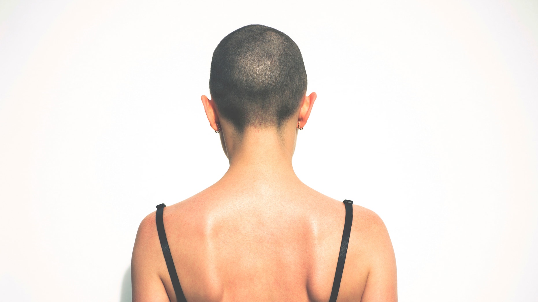 Hairless woman