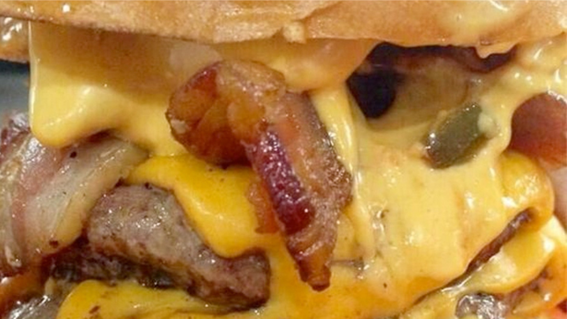 Nicola Peate dislocated her jaw while enjoying a burger at Almost Famous in the U.K..