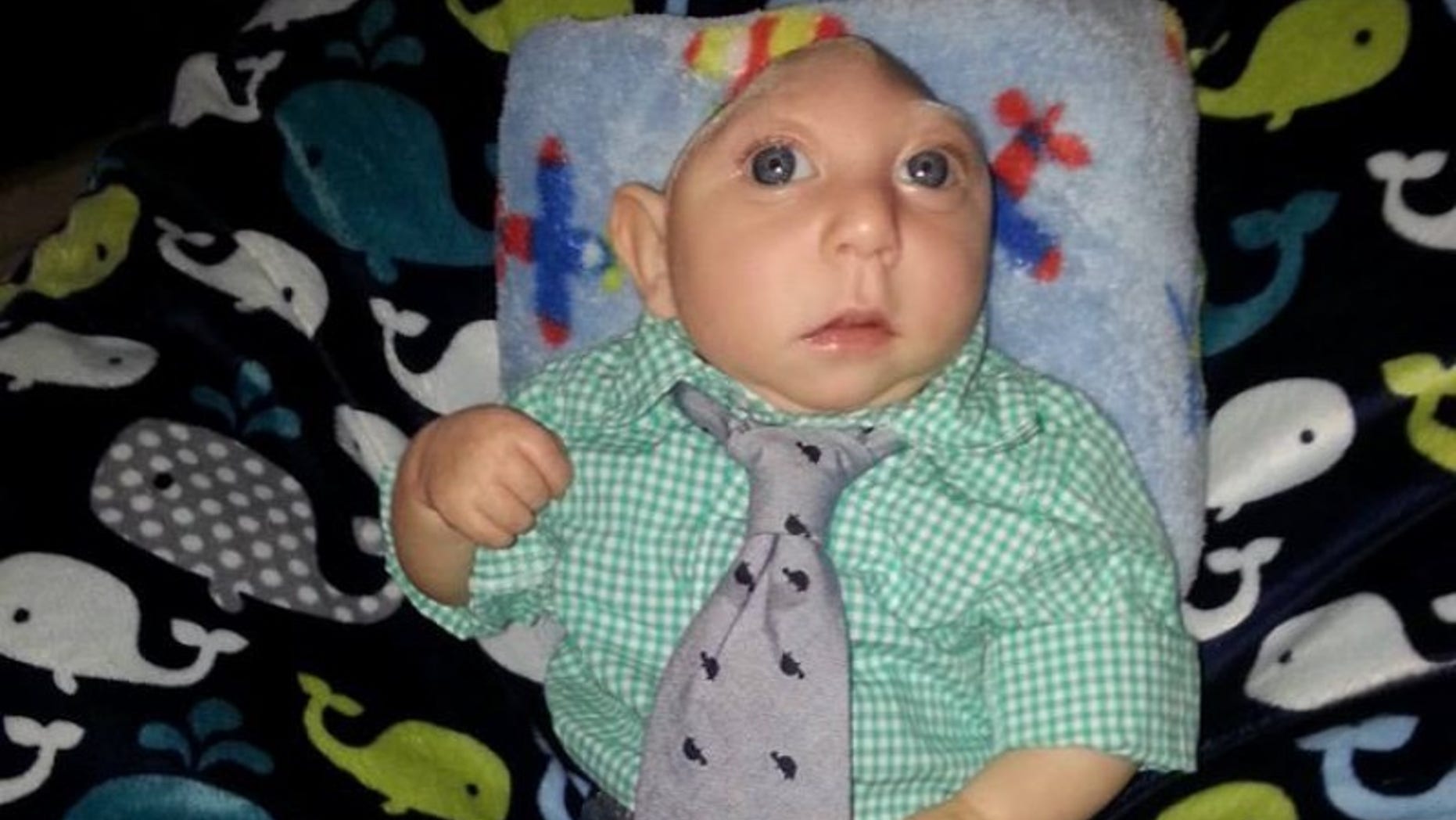 Jaxon Buell was born on August 27, 2014, and was recently diagnosed with microhydranencephaly, an extreme brain malformation for which there is no known cure.