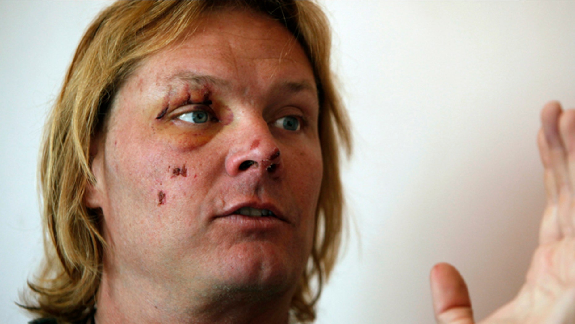 May 22, 2014: Western Kentucky University professor John All speaks during an interview with The Associated Press in Katmandu, Nepal. The American climber said he fell into a crevasse on a mountain in Nepal but managed to crawl to his tent despite broken ribs and an arm before being rescued the next morning.