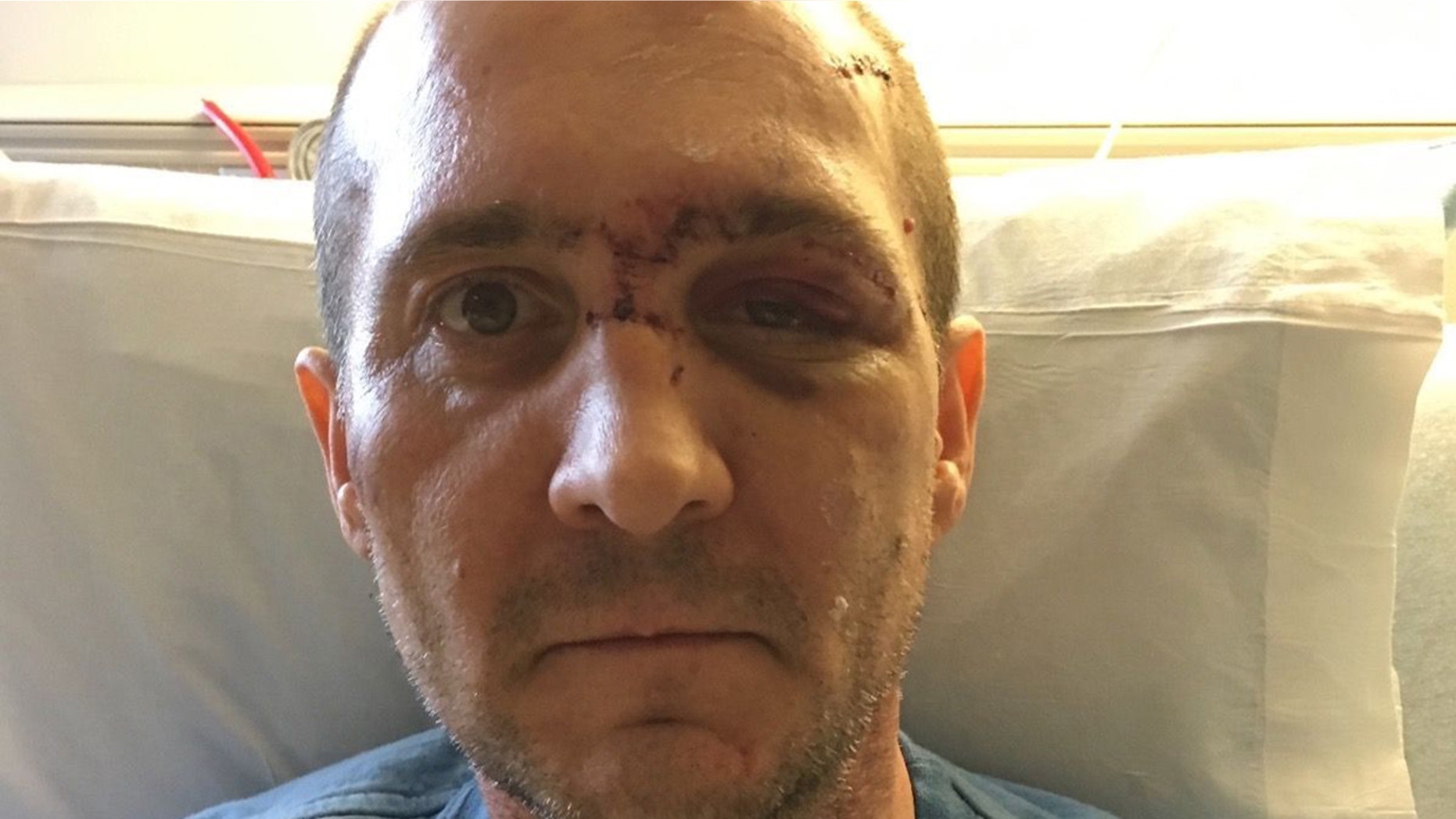 Joshua Morrison told Fox 12 intruders ambushed him in his home.
