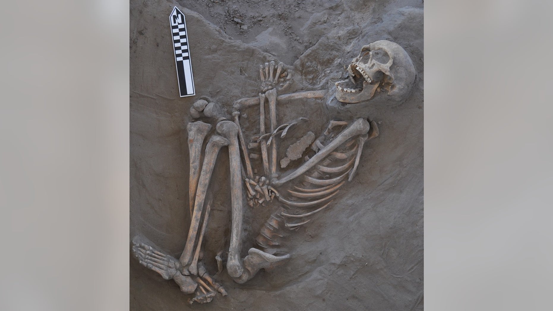 The 800-year-old skeleton now called Kaakutja had a long gash in its skull, likely due to a boomerang attack.