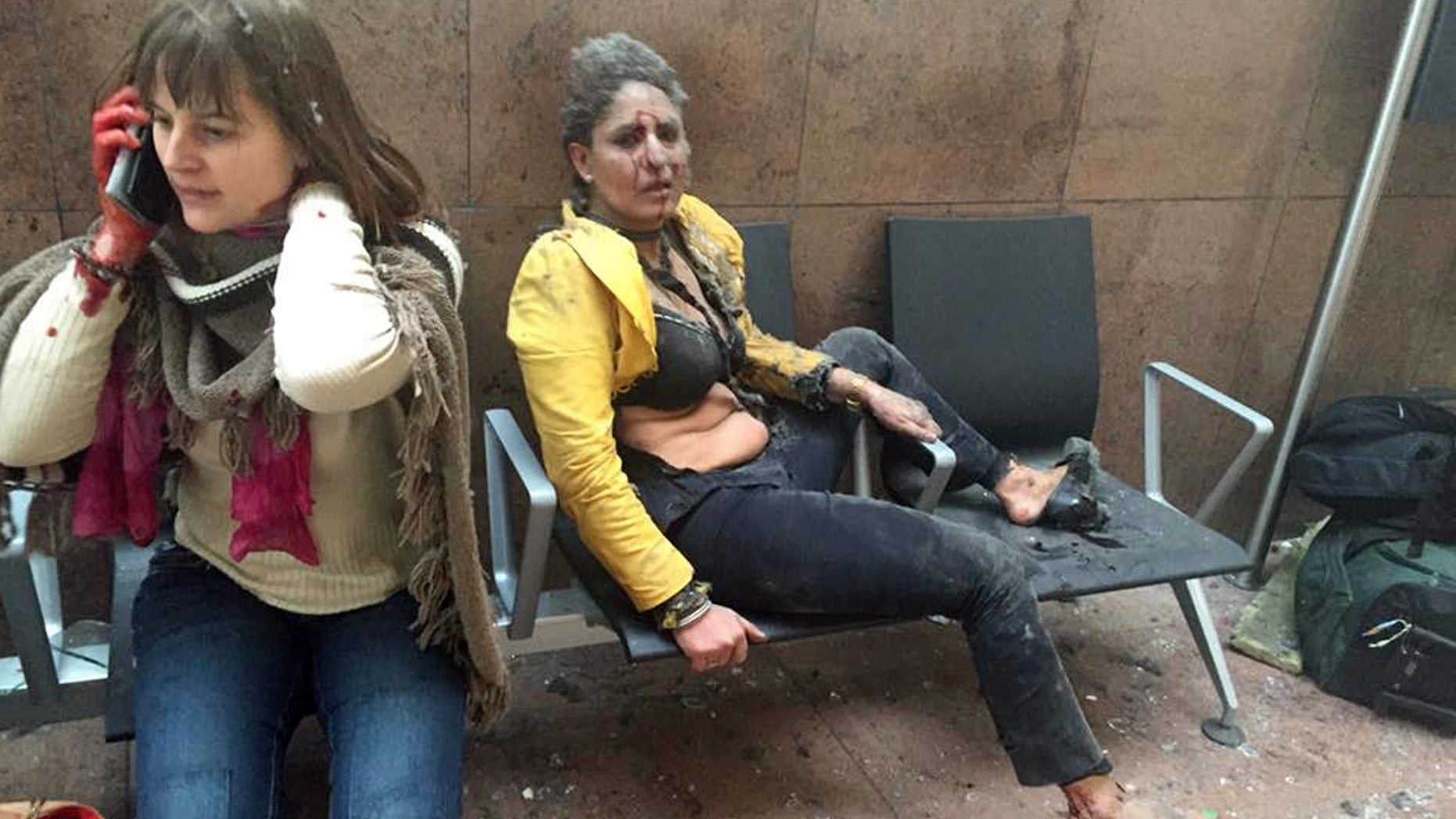 Two wounded women at the Brussels airport Tuesday.