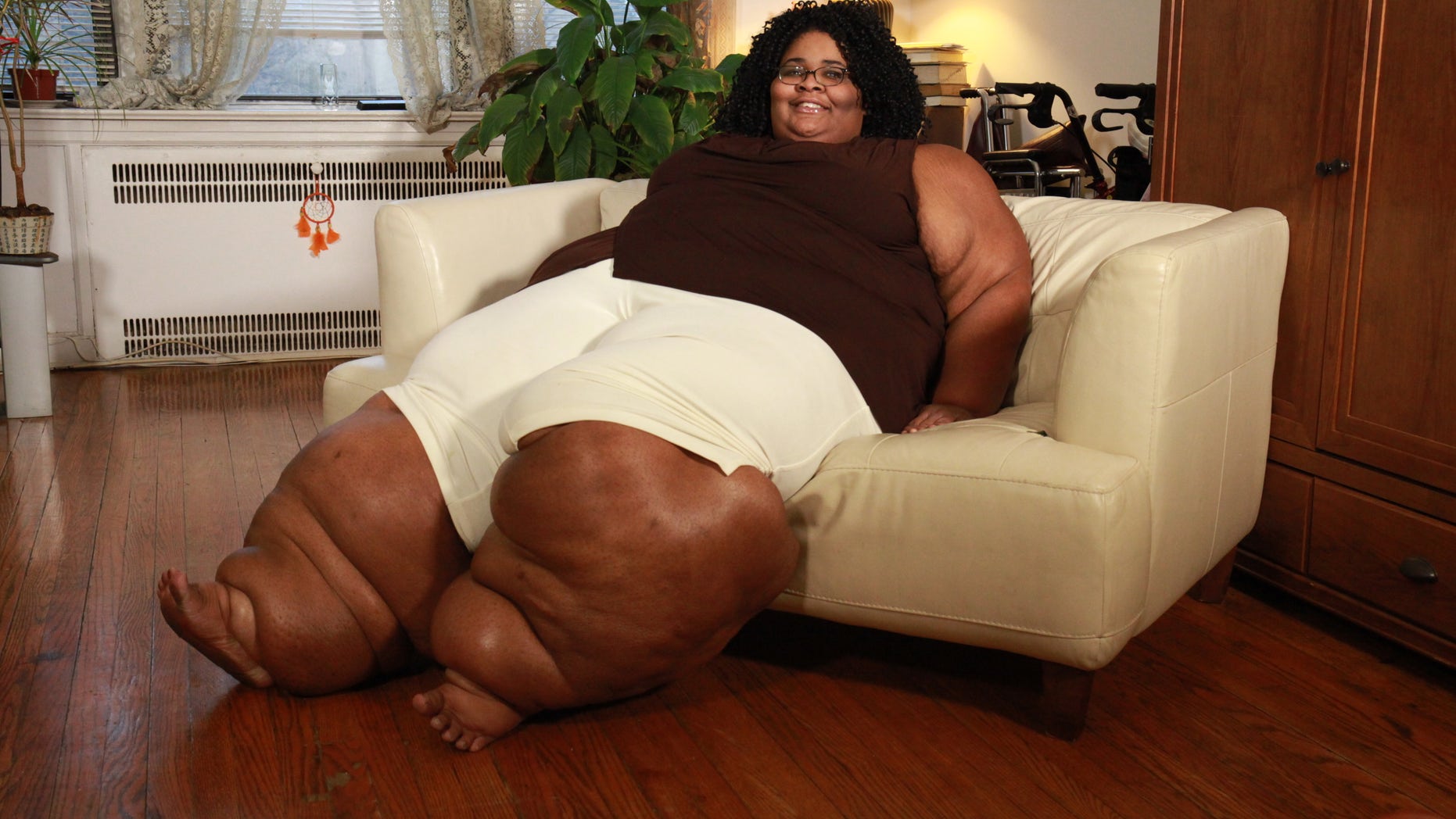 Katia Page from New Jersey suffers with lipedema, a chronic disorder that causes fatty tissue to accumulate in mass around the lower body.