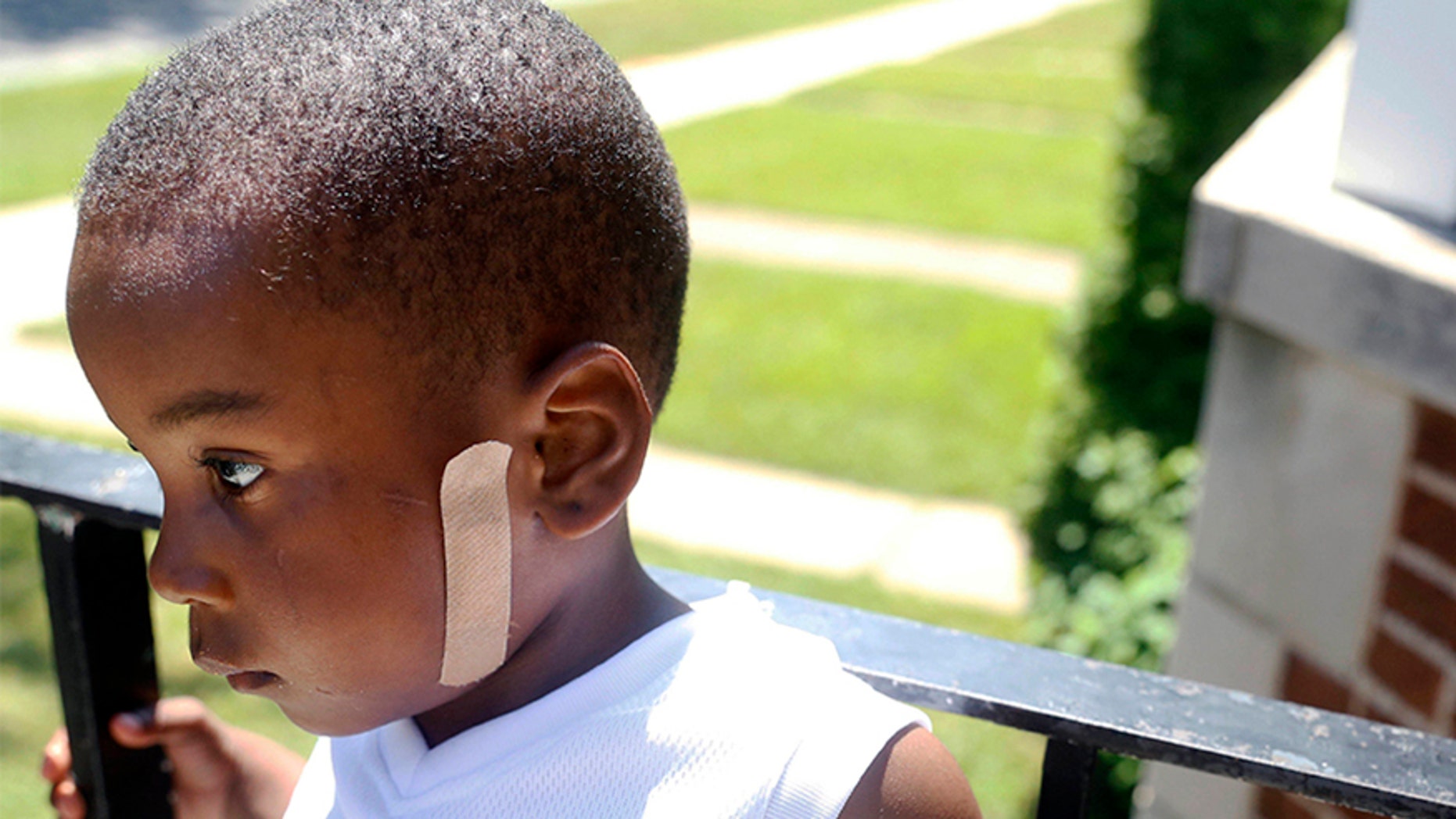 Kavan Collins, a month after he was shot in the face in June 2016.