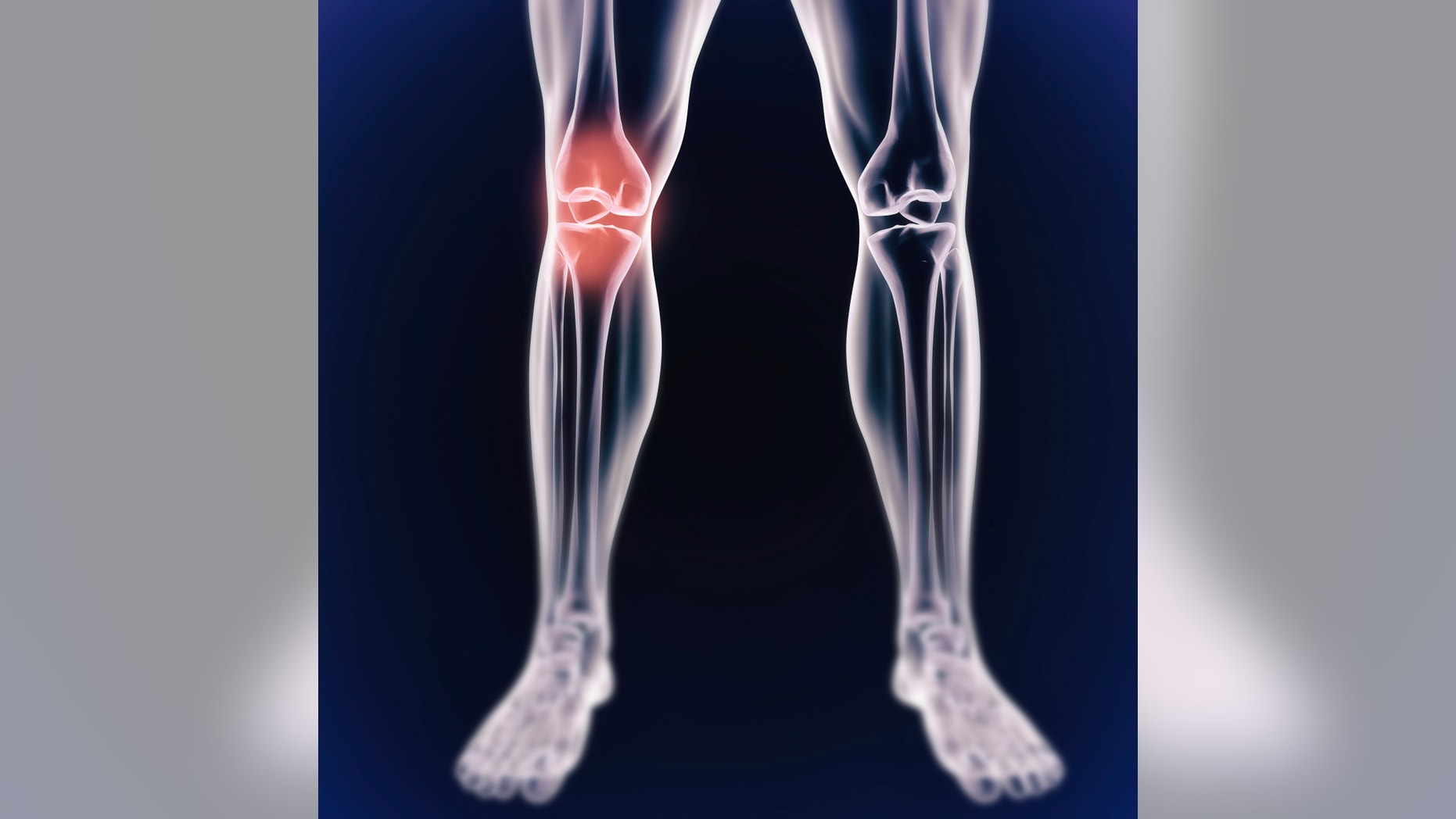 A cgi view of an inflamed joint isolated on blue