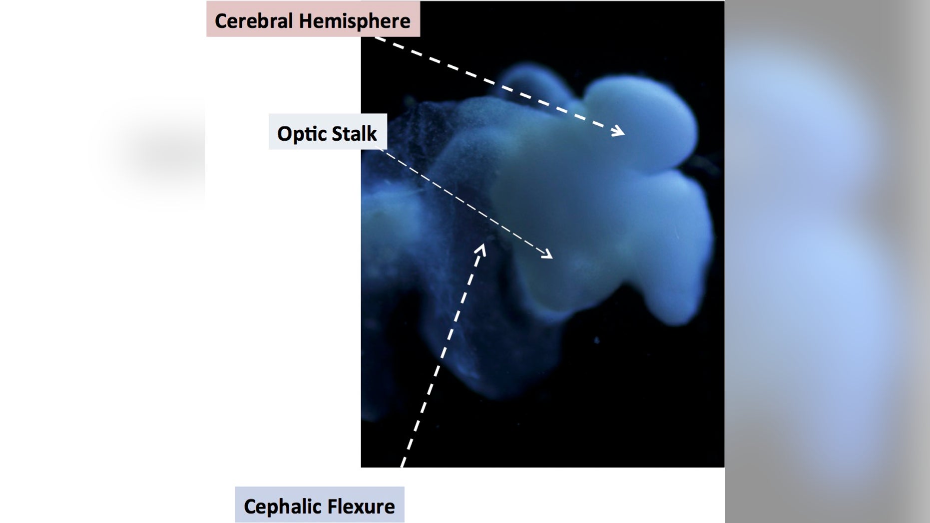 This image of the lab-grown brain is labeled to show identifiable structures: the cerebral hemisphere, the optic stalk and the cephalic flexure, a bend in the mid-brain region, all characteristic of the human fetal brain.