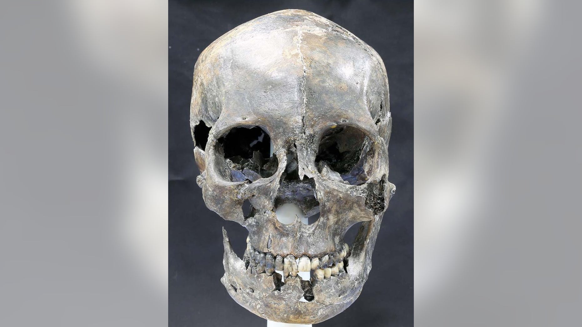 The 1,500-year-old skull (shown here after reconstruction) of a woman, who was part of an ancient royal dynasty called the Silla culture, shows she had an elongated head.