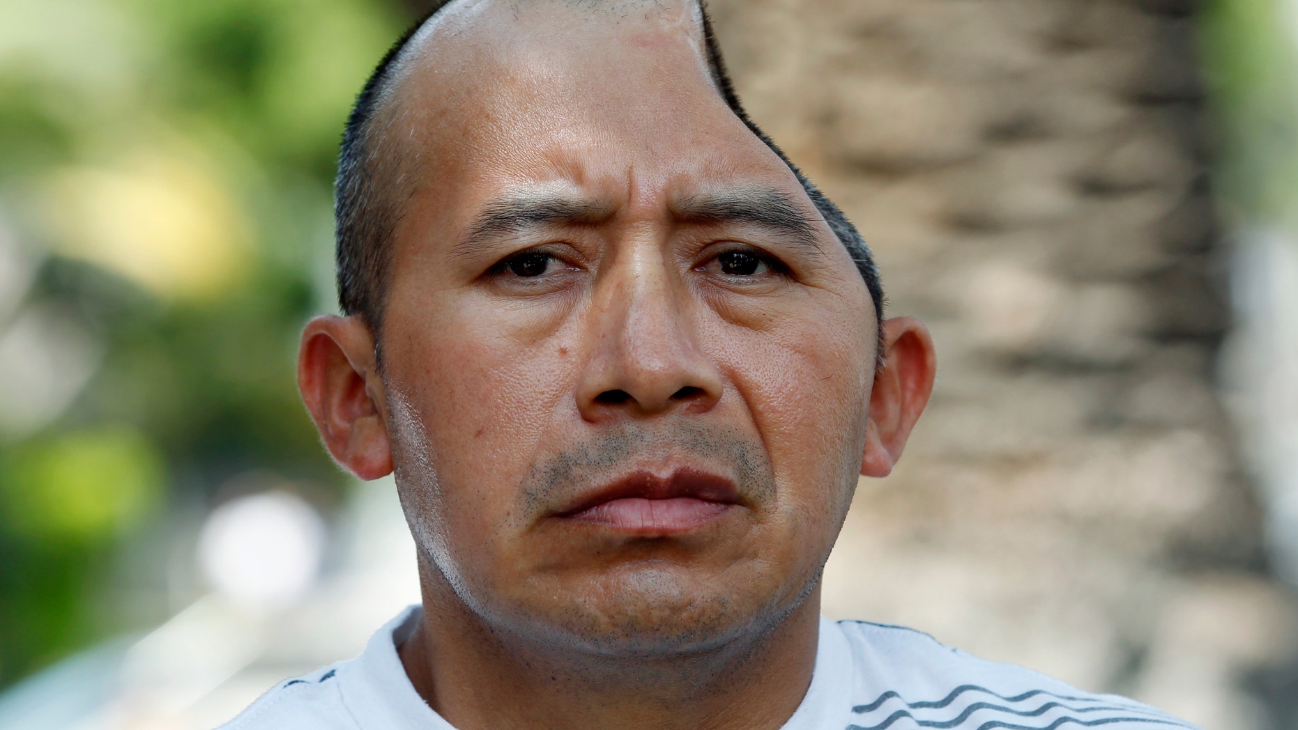 Antonio Lopez Chaj, a 43-year-old house painter, appears with his attorneys at a news conference in Los Angeles Monday, July 1, 2013. Lopez Chaj is so badly brain damaged for a beating in a bar that left him with half his skull permanently bashed in that he cannot speak. His lawyers announced he has been awarded a $58 million by a jury in Torrance Superior Court. (AP Photo/Nick Ut)