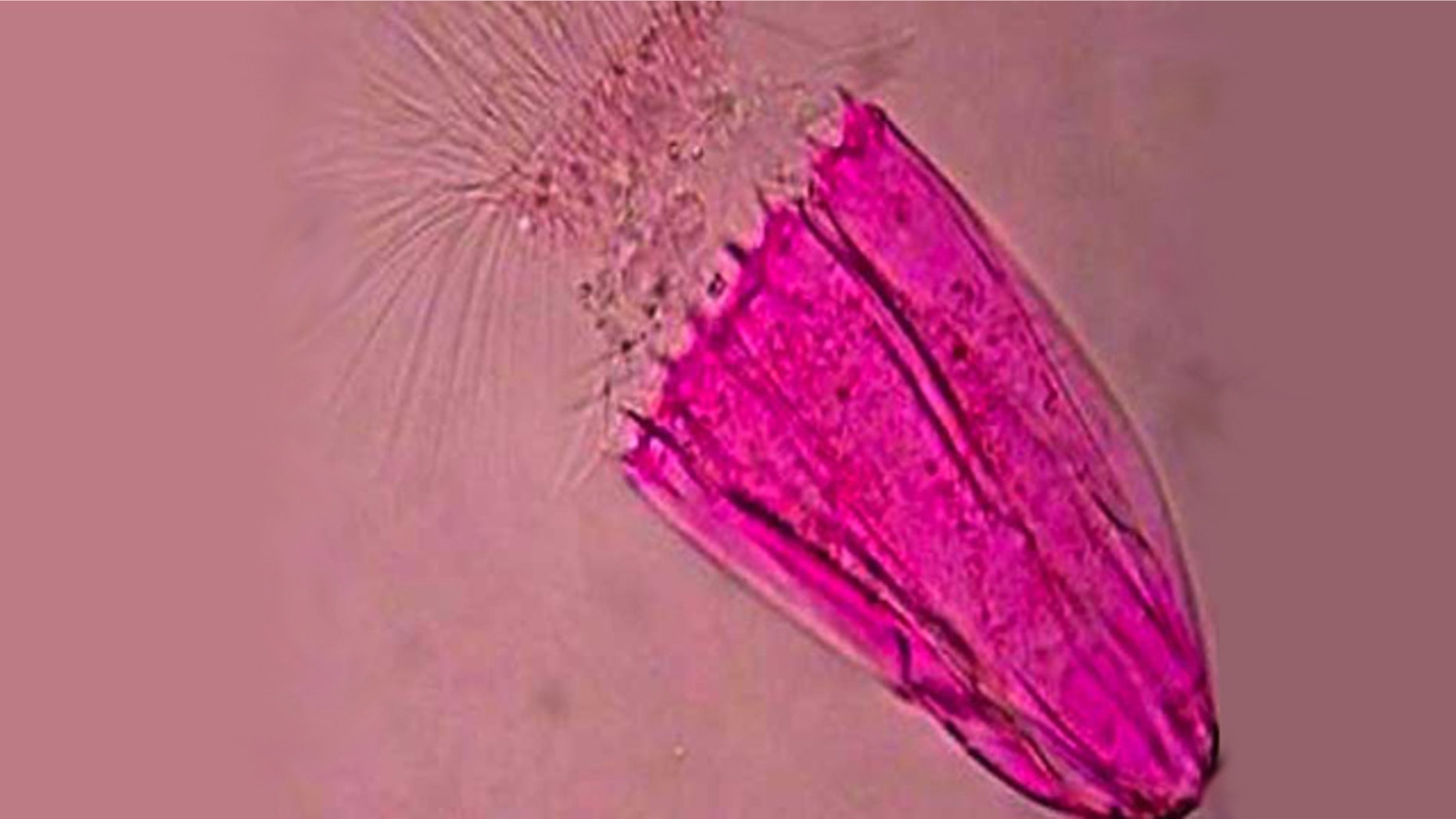 This newfound creature, a loriciferan found more than 10,000 feet deep off the southern coast of Greece, lives completely without oxygen. This specimen is stained red.