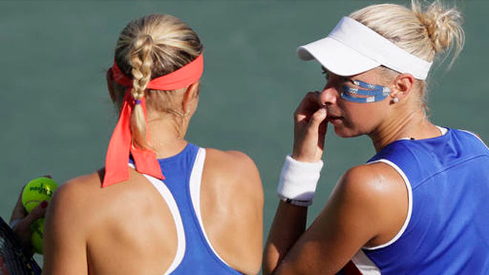 Tape around the eye of Andrea Hlavackova as she plays with partner Lucie Hradecka during women's doubles bronze medal tennis match at the 2016 Summer Olympics Saturday.