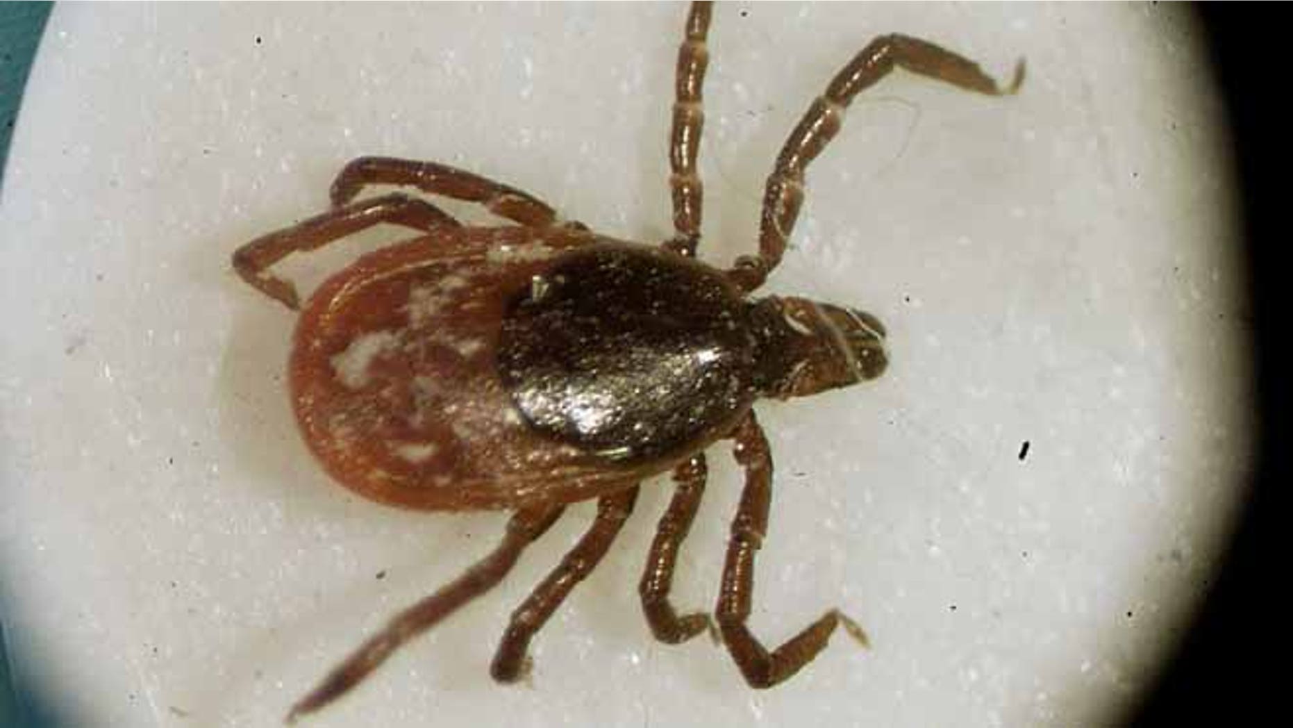 March 2002: This file photo shows a deer tick under a microscope in the entomology lab at the University of Rhode Island in South Kingstown, R.I.