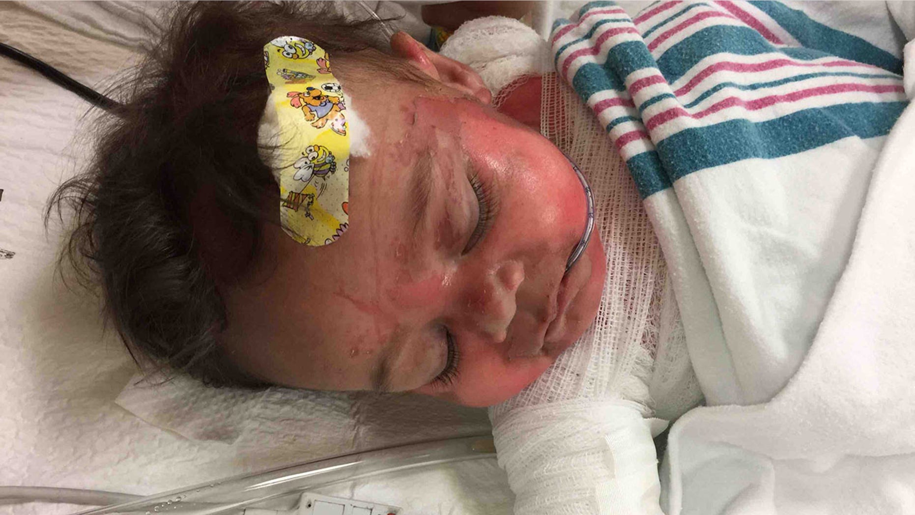Maddox Lee Stover was under the care of an adult-aged babysitter when he obtained his injuries.