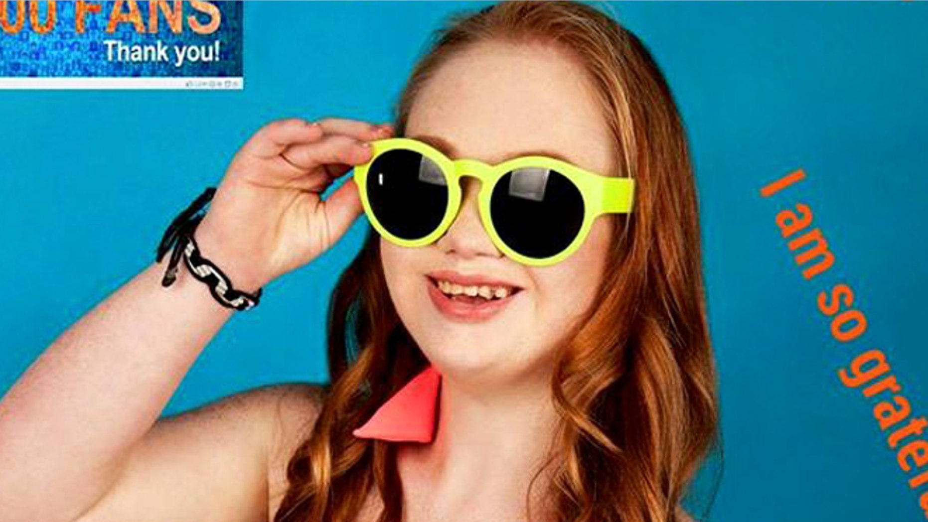 Madeline Stuart has Down syndrome and is looking to change traditional modeling standards.