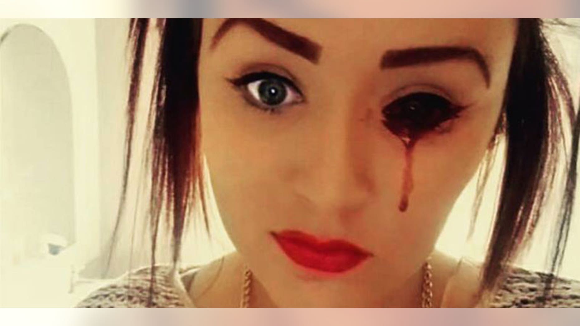 Marnie-Rae Harvey, 17, bleeds from her eyes and ears up to five times per day, but doctors cannot figure out why.