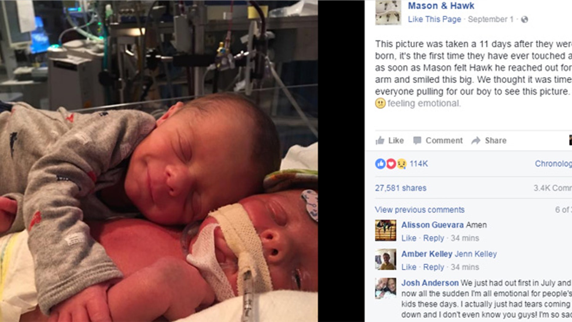 This photo shows the first time brothers Mason and Hawk touched each other.