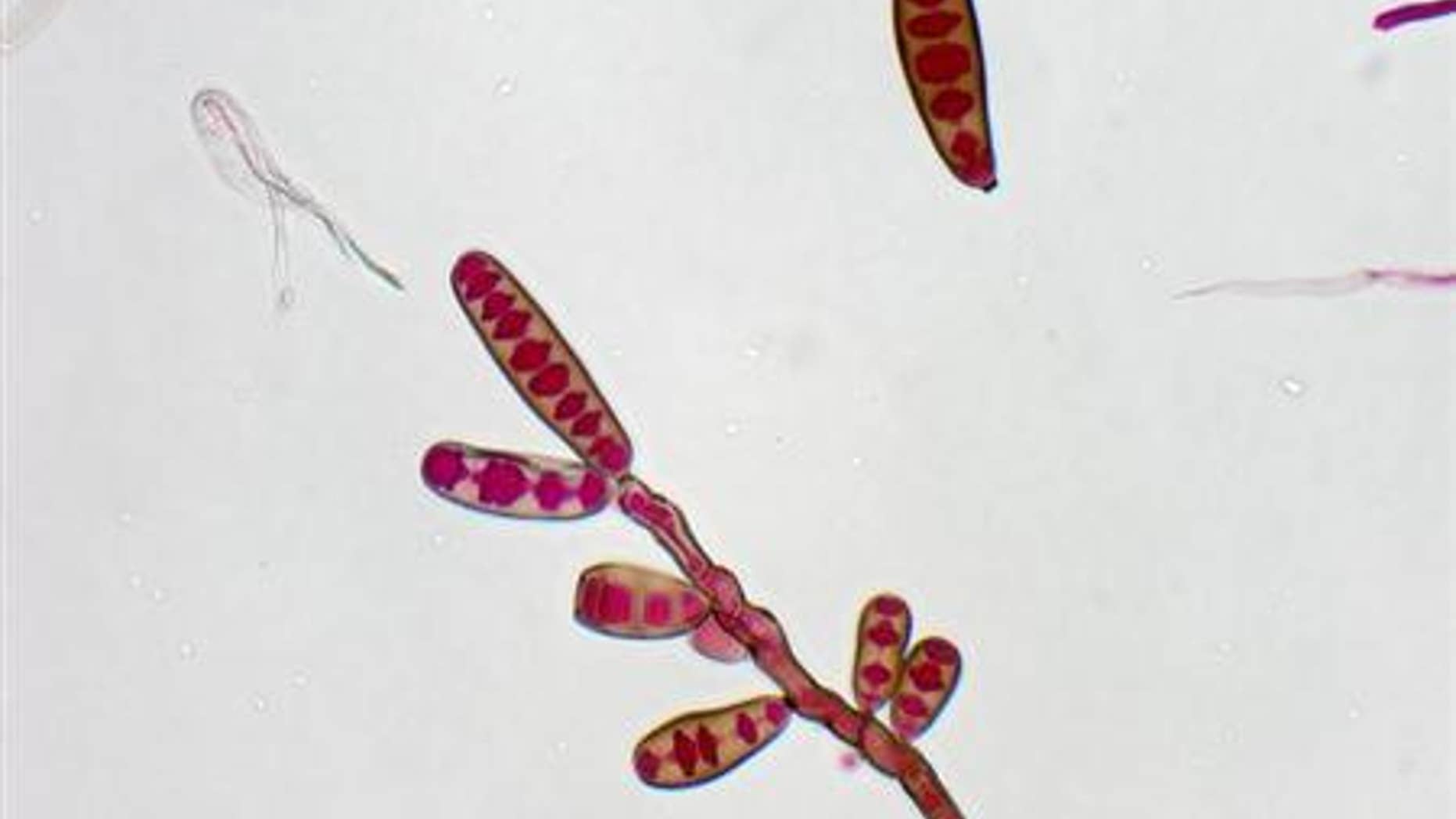 Exserohilum rostratum, a type of fungi, is seen in this handout image from the Centres for Disease Control