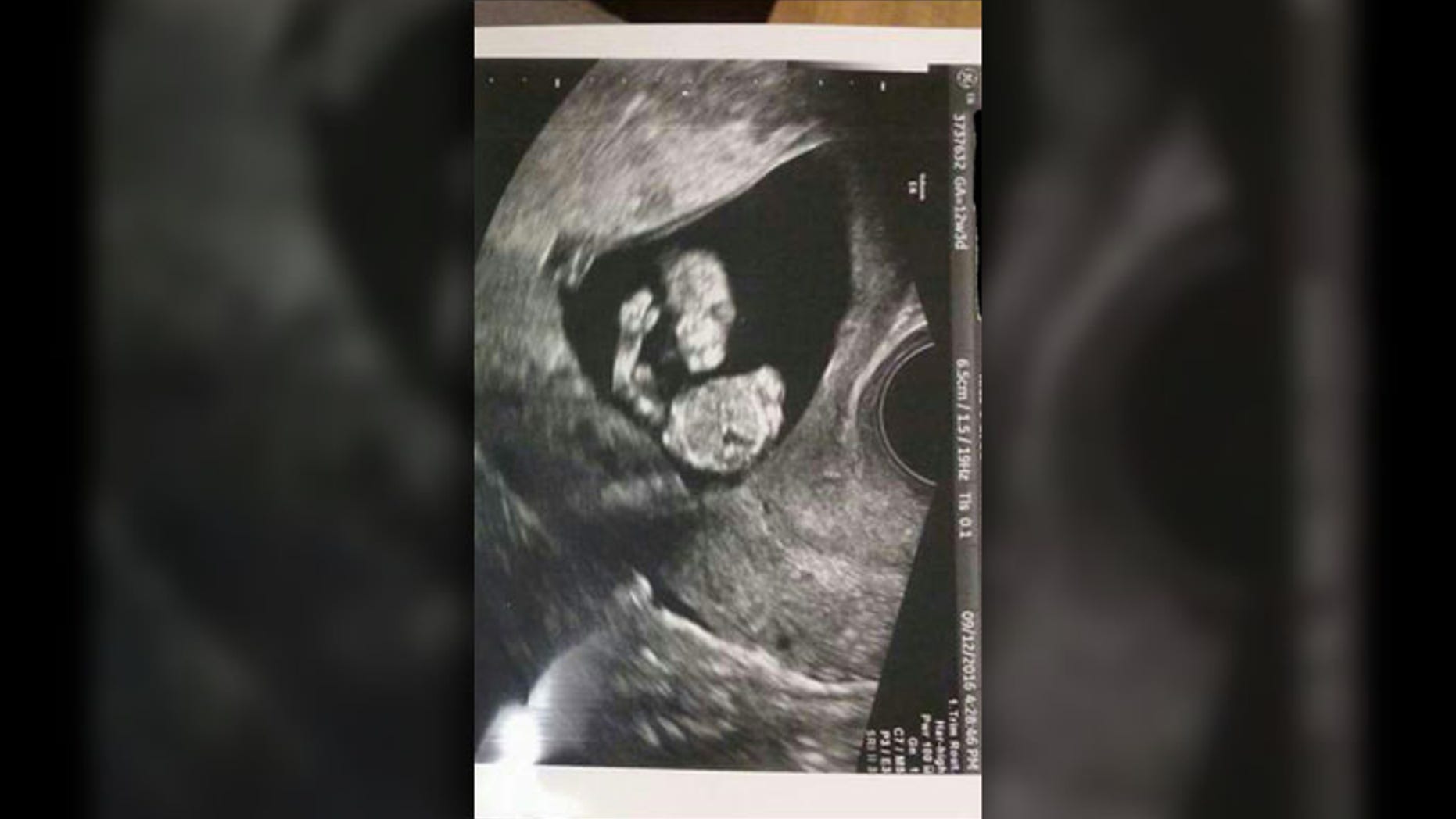 (Fox54/Mehgan Merriott)