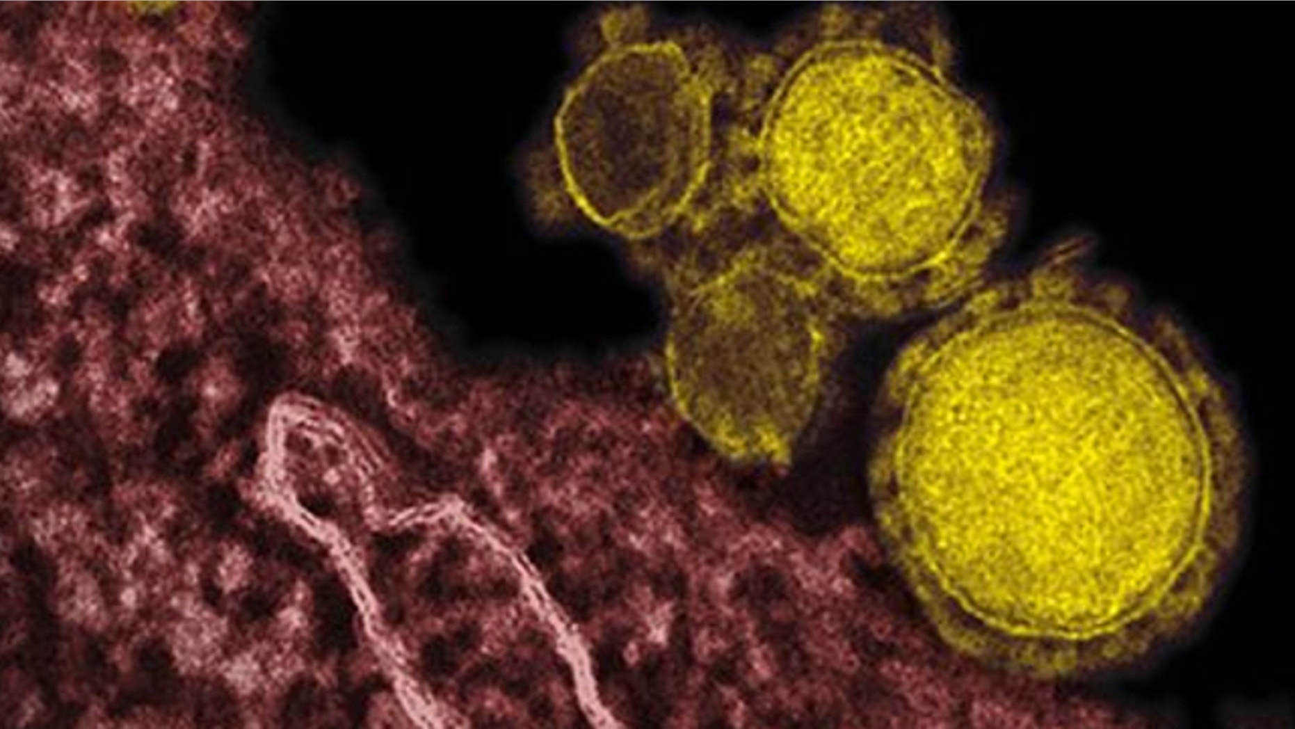 UNDATED: This electron microscope image made availalbe by the National Institute of Allergy and Infections Diseases - Rocky Mountain Laboratories shows novel coronavirus particles, also known as the MERS virus, colorized in yellow.