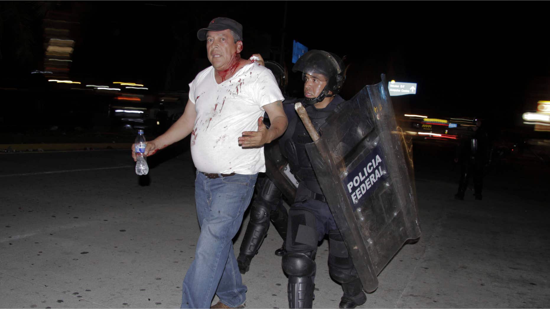 Feb. 24, 2015: An injured protester is taken into custody by police during a protest demanding better labor conditions for teachers in Acapulco, Mexico.