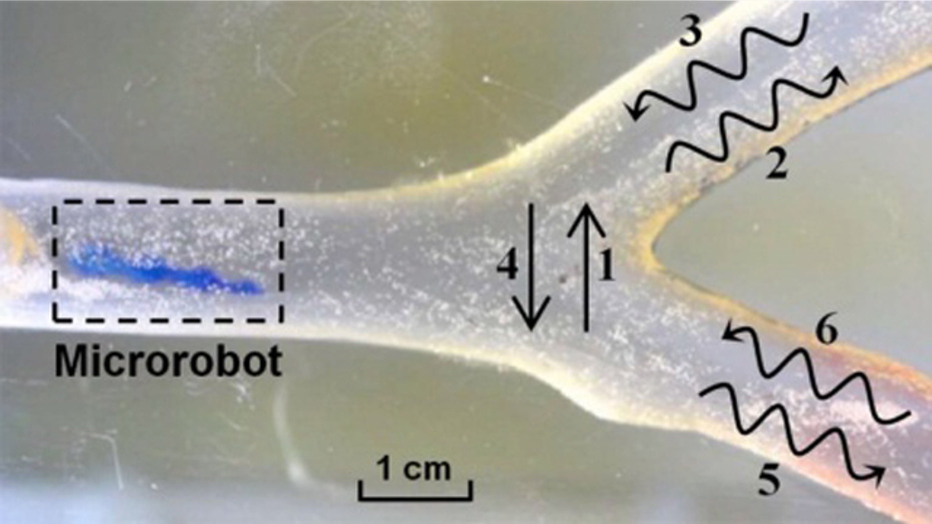 Researchers in South Korea demonstrated a microrobot moving through a structure intended to simulate the environment of a blood vessel. The microbot can move up and down (1 and 2), and wiggle through the simulated vessel in a helical motion (2, 3, 5, 6).