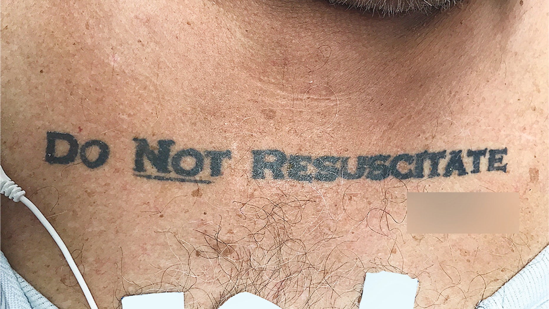 Doctors faced an ethical dilemma after an elderly man with a "Do Not Resuscitate" tattoo on his chest appeared in their emergency room, unconscious and near death.