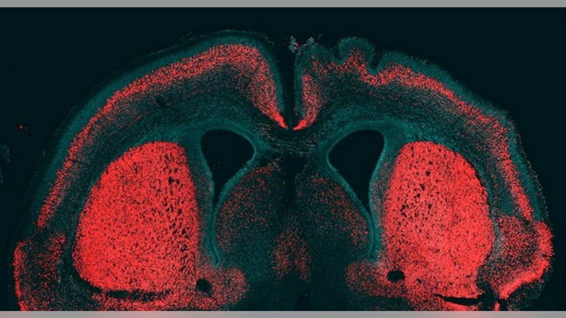 New research suggests that a single gene may be responsible for the large number of neurons found uniquely in the human brain. When this gene was inserted in the brain of a mouse embryo (shown here), it induced the formation of many more neuron