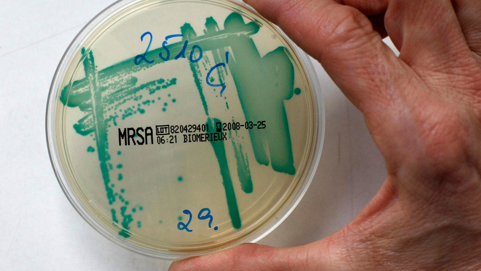 MRSA (Methicillin resistant Staphylococcus Aureus) bacteria strain is seen in a petri dish containing a special jelly for bacterial culture in a microbiological laboratory in Berlin March 1, 2008. REUTERS/Fabrizio Bensch (GERMANY)