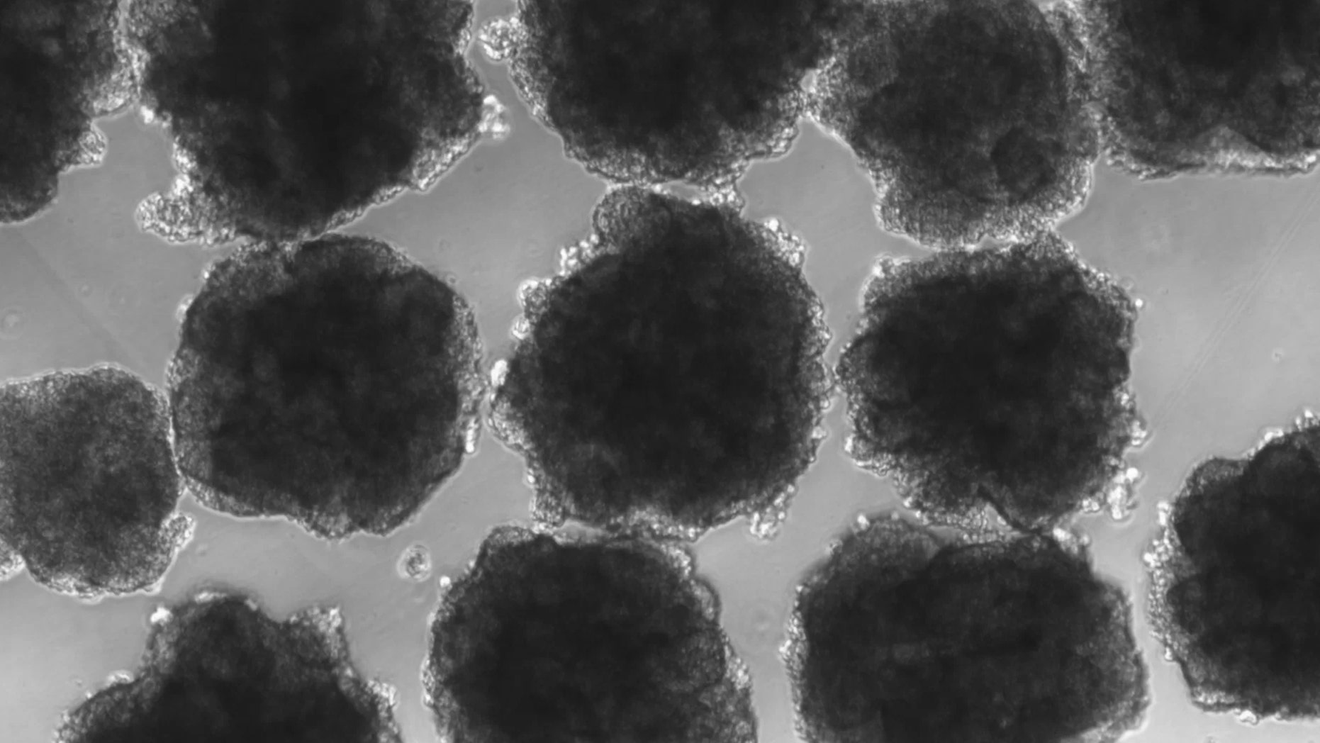 The pea-size, Neanderthalized mini brains that carry the ancestral NOVA1 gene. Each "pea" has about 400,000 cells. Credit: Alysson Muotri