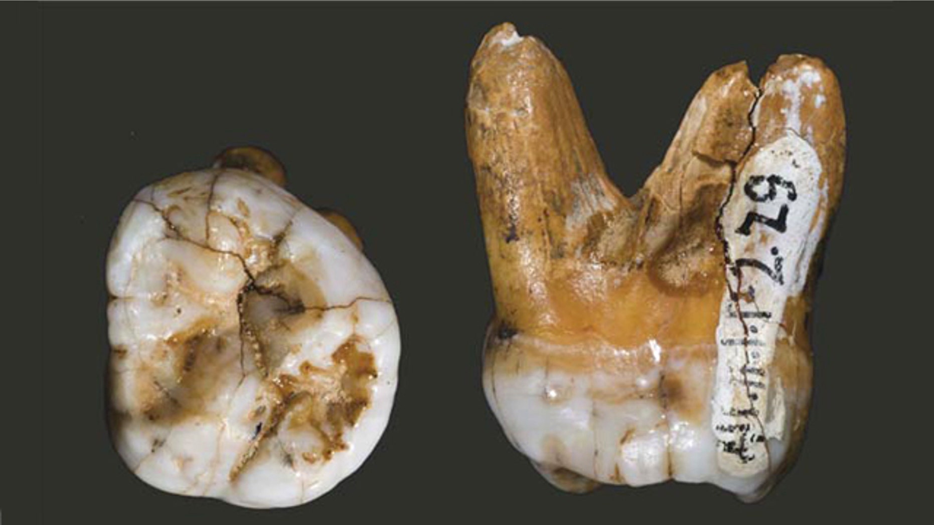 A molar tooth belonging to a Denisovan, thought to be a new branch of ancient humans.