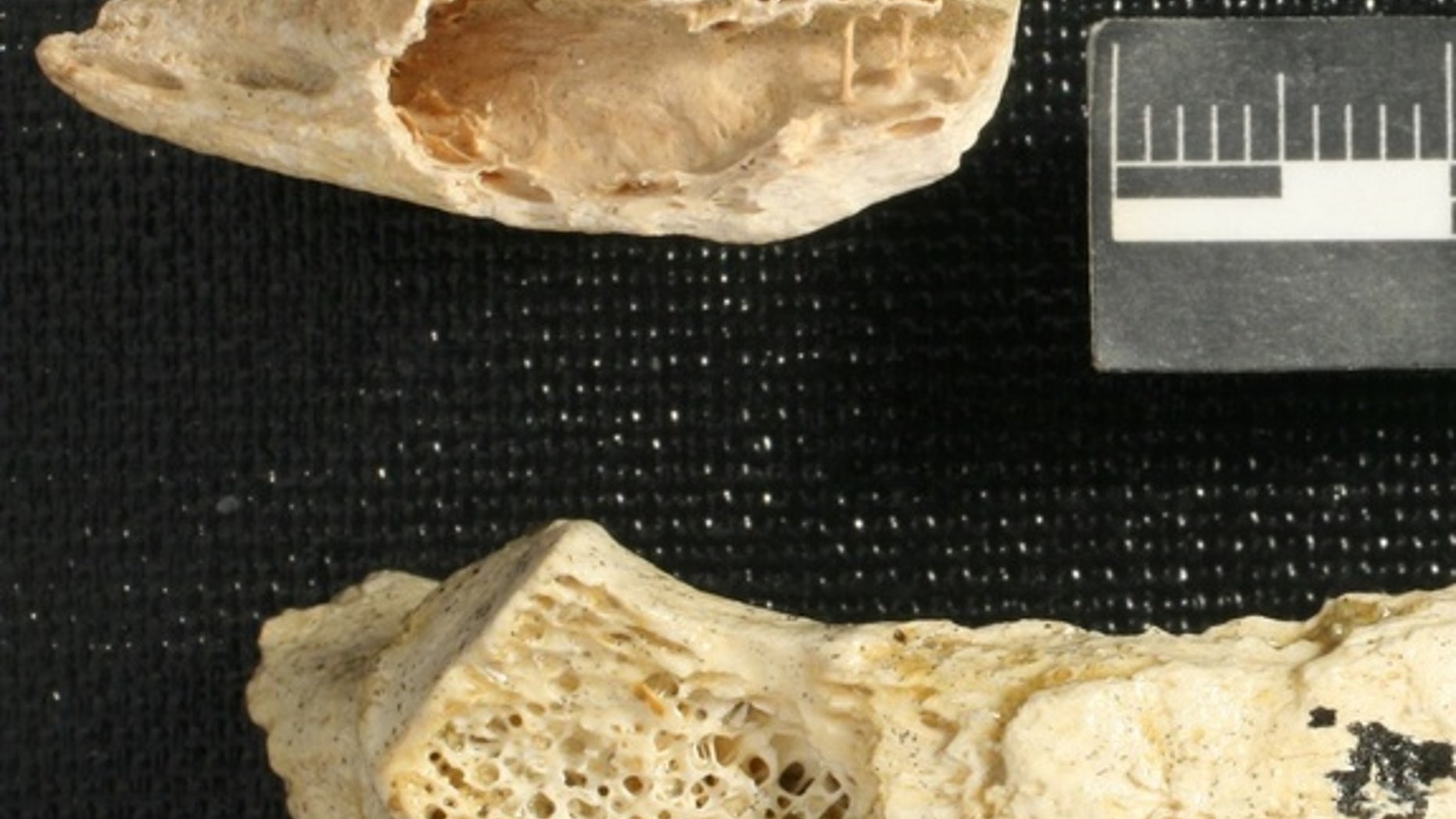 A Neanderthal rib fragment (top) reveals a gaping cavity where weblike spongey bone should be (see healthy rib, bottom). This cavity is evidence of the oldest known human tumor ever found, reported June 5, 2013 in the journal PLOS ONE.