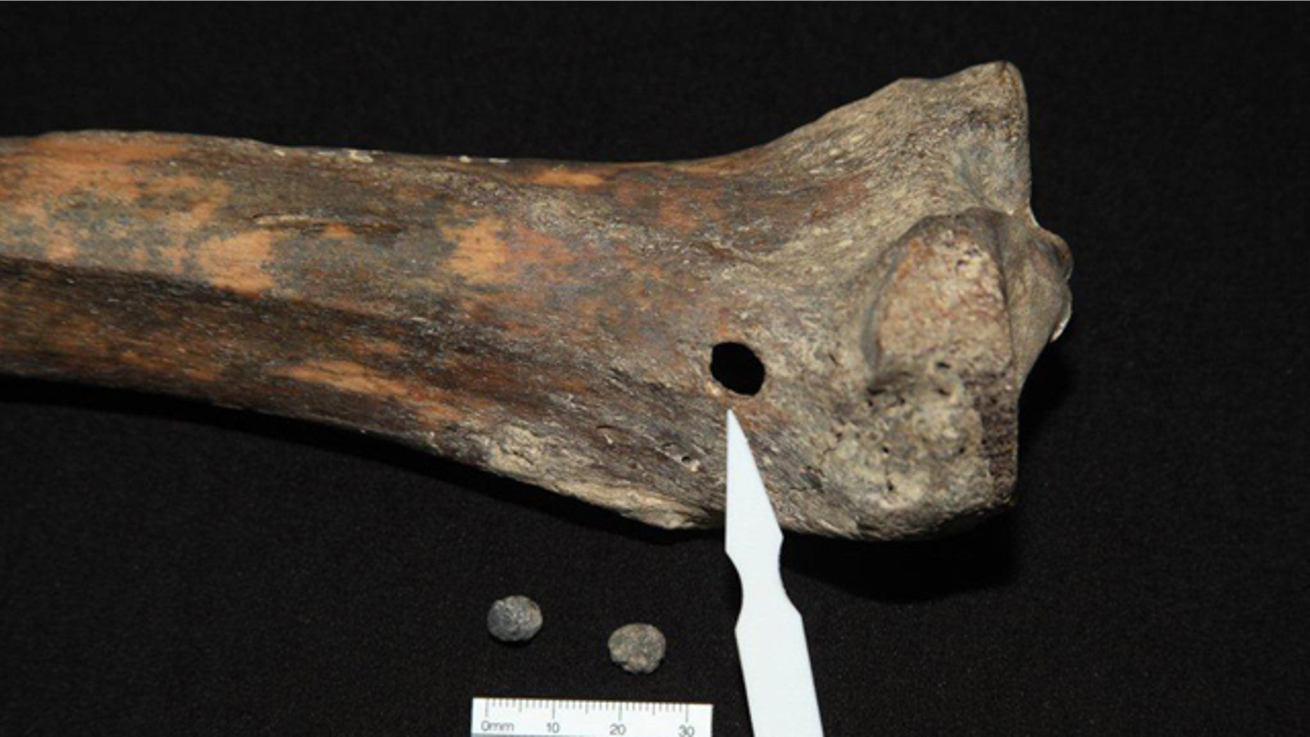 Sept. 1: In this photo supplied by Victorian Institute of Forensic Medicine, the right tibia of Australia's most infamous criminal, Ned Kelly is shown in Melbourne, Australia. Through CT scans, X-rays, anthropological and historical research and DNA analysis, a team of scientists finally identified one of the skeletons exhumed with the remains of other executed inmates from a mass grave, as Kelly's.