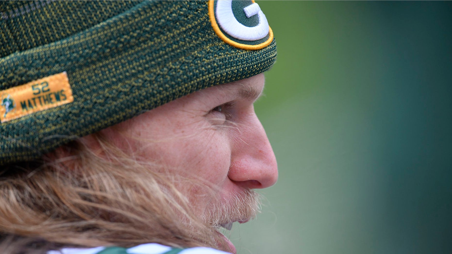 Clay Matthews was injured in a charity softball game over the weekend.